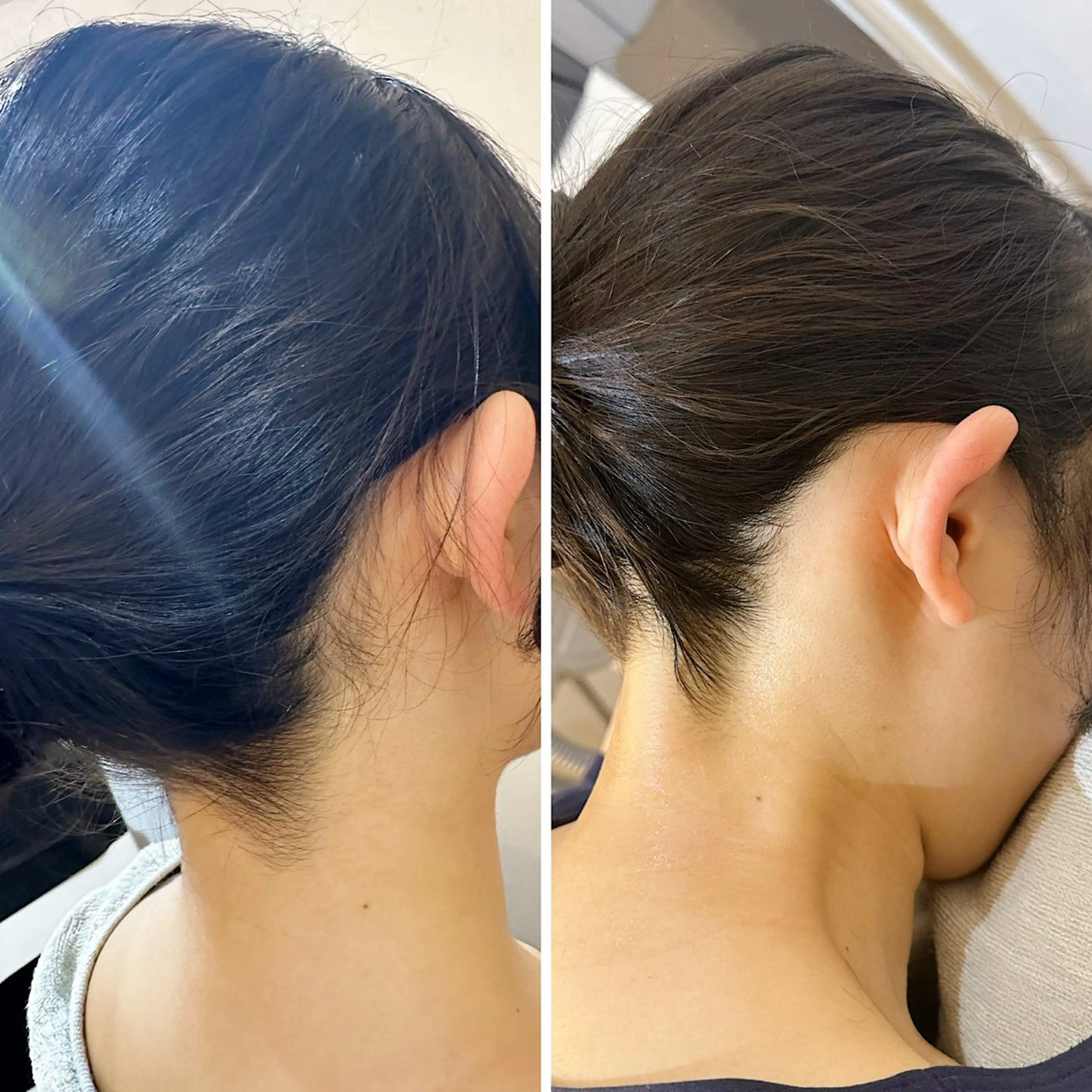 脱毛 うなじ脱毛/美肌脱毛 LABELのエステ・リラクイメージ