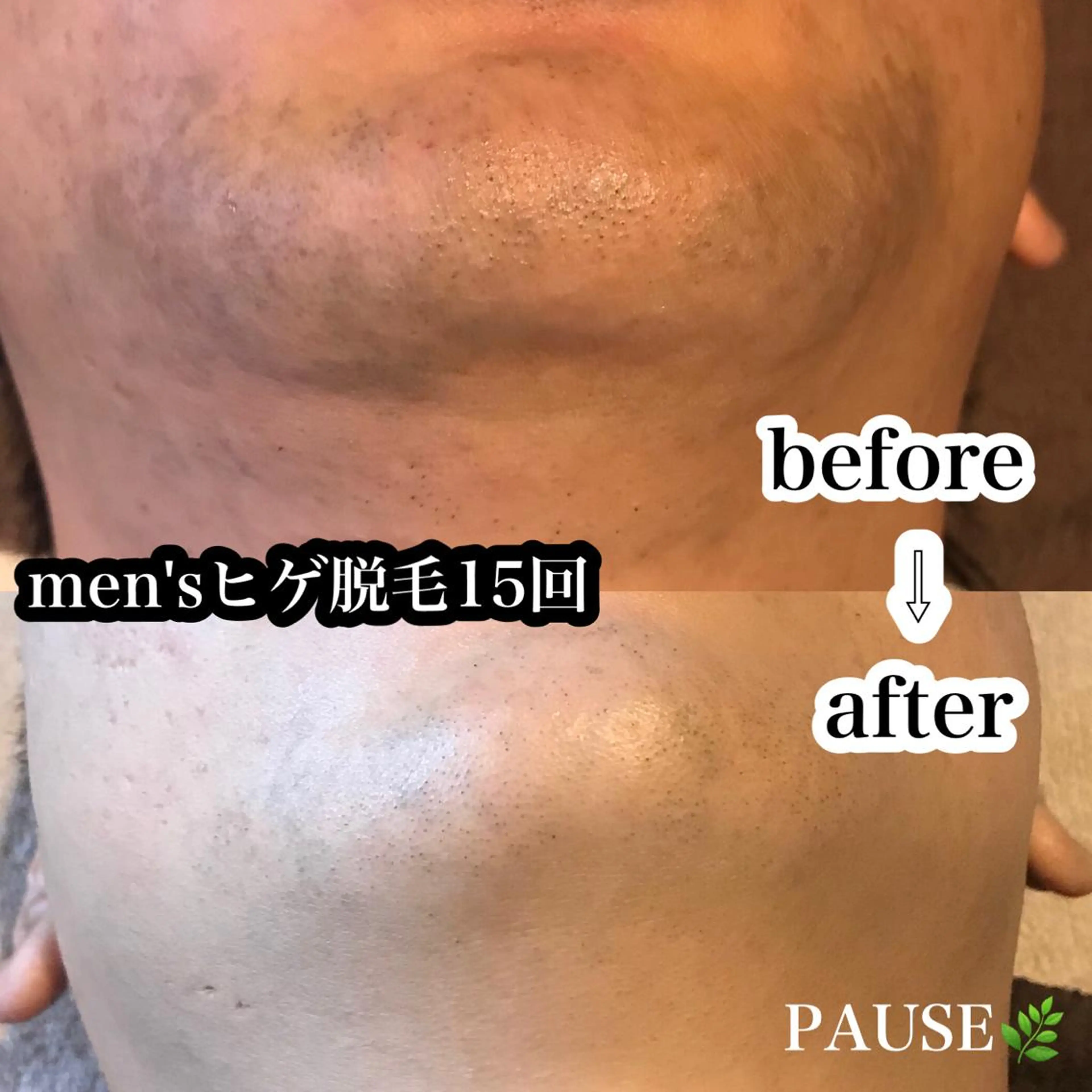 脱毛 浜野 恵美のエステ・リラクイメージ