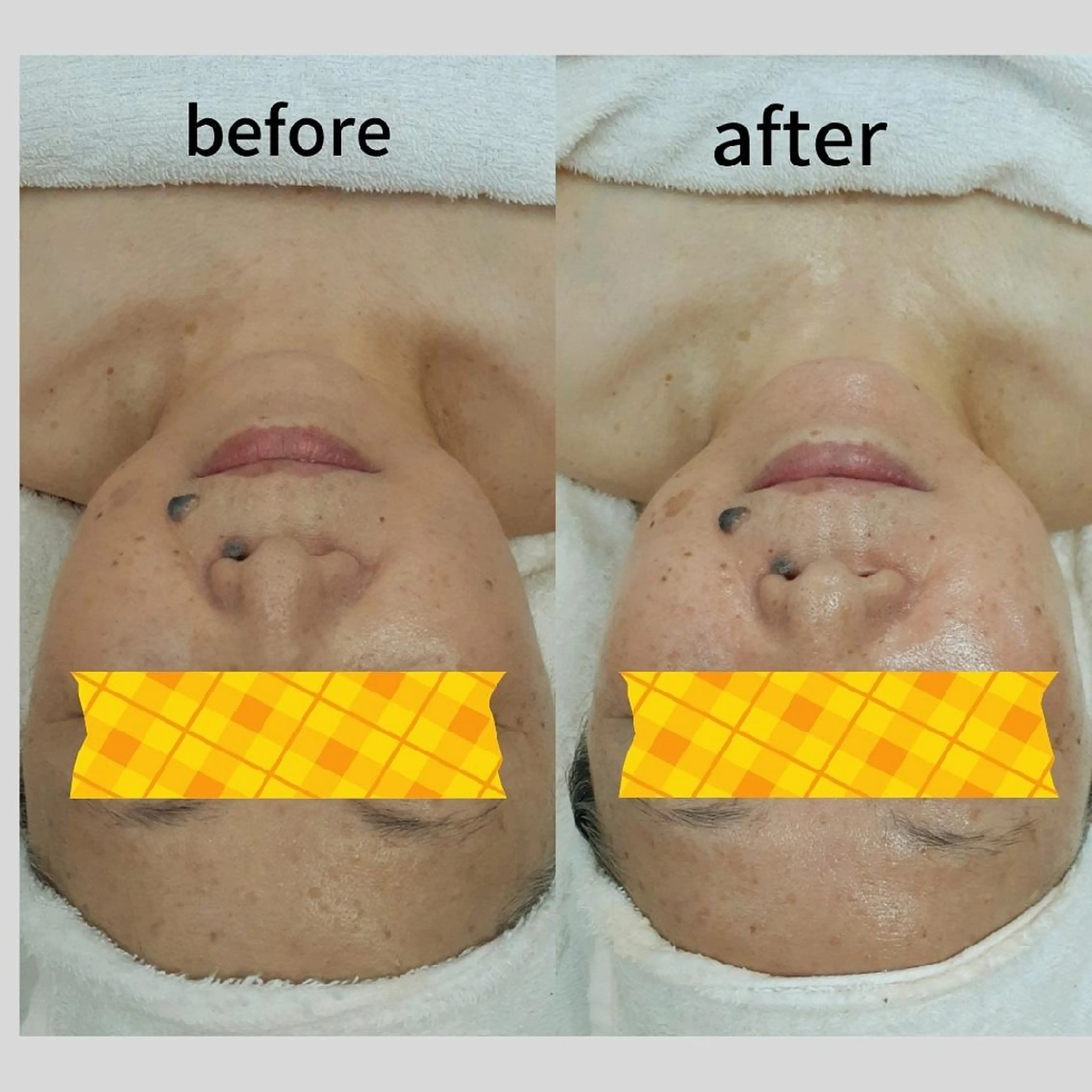 メナードフェイシャルサロンライズミュー所属・鈴木 由美のエステ・リラクイメージ