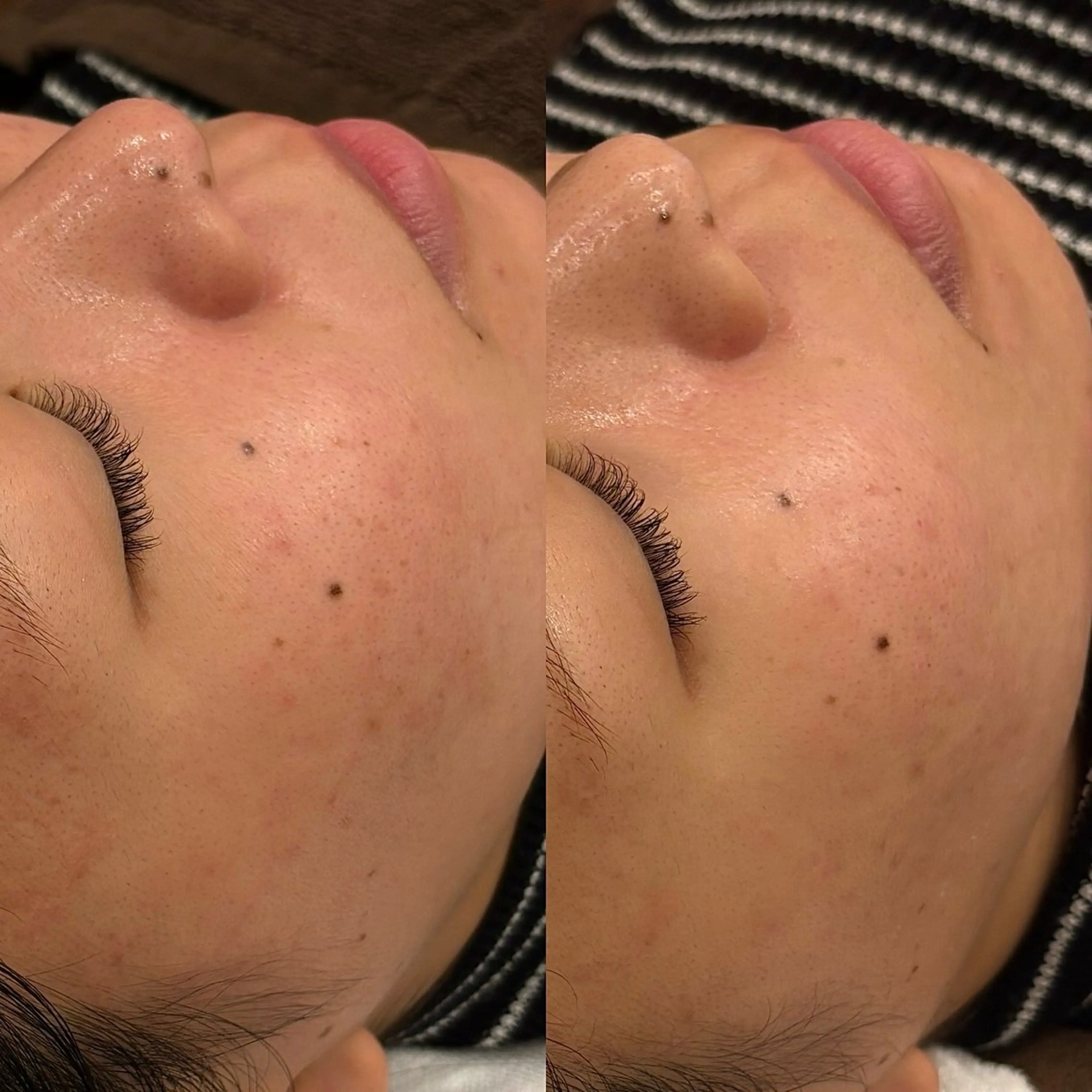 chika🦋 ハリラウンジ恵比寿のエステ・リラクイメージ