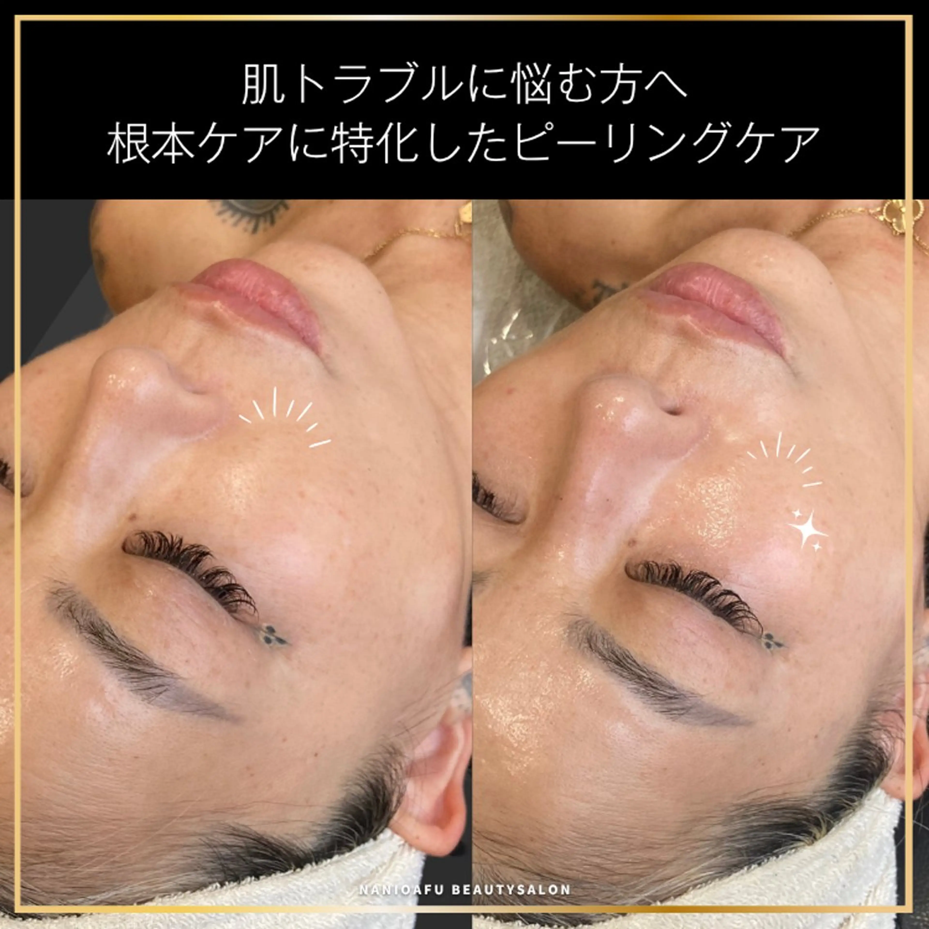 エステ NANIOAFU [本町店]のその他イメージ