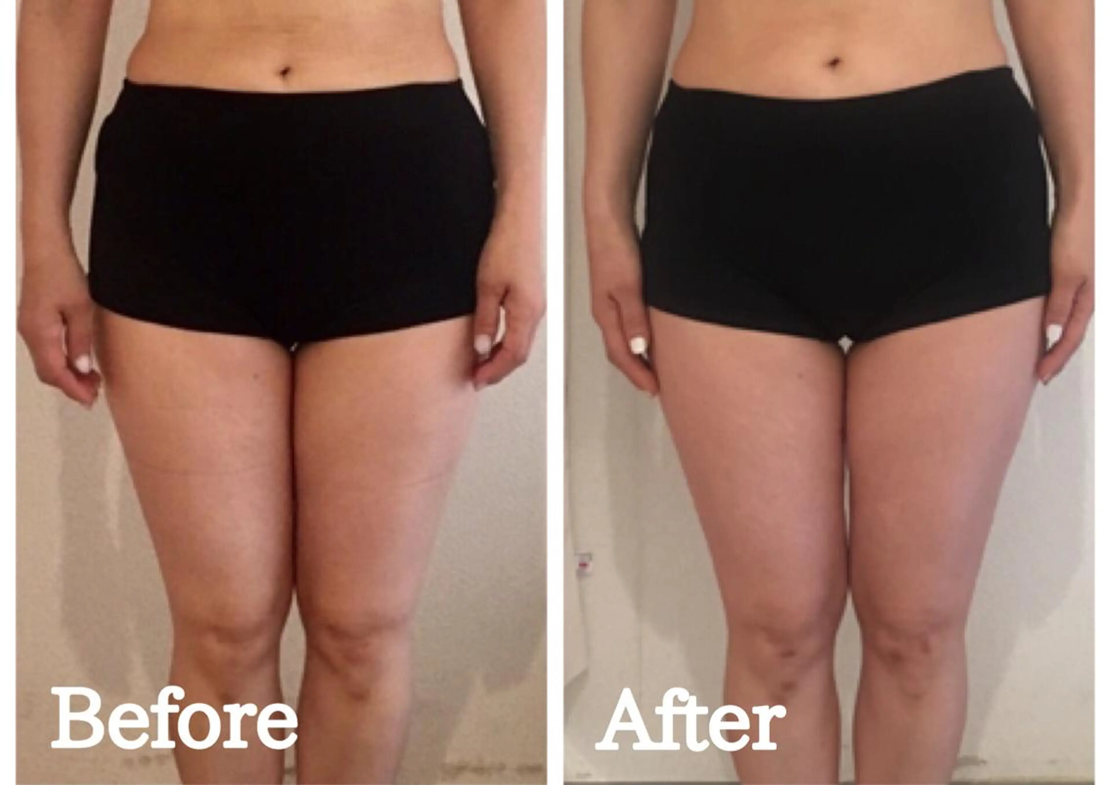 Re+(リプラス整体 院:やまみち)のエステ・リラクイメージ