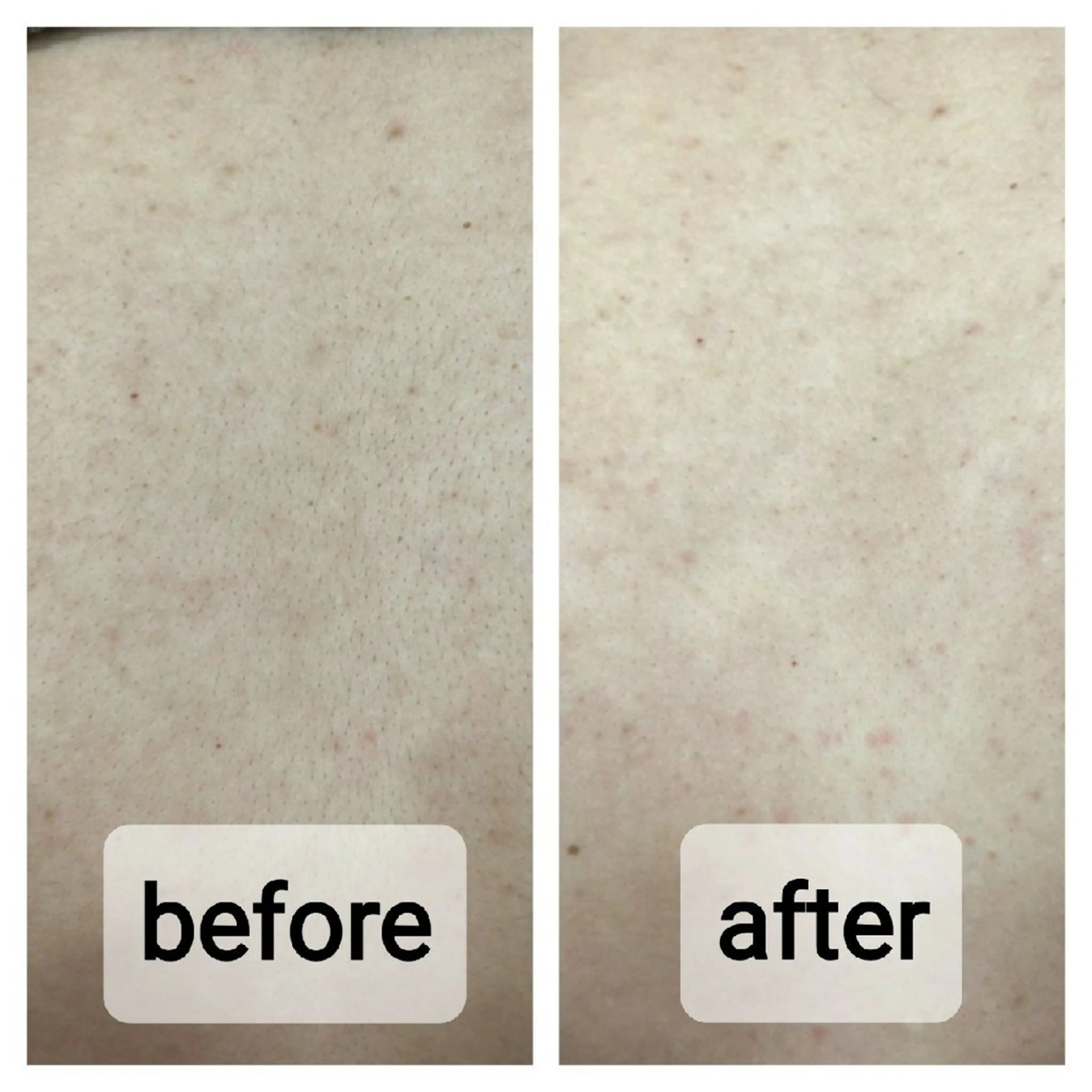 N.Sサロン Miyauchiのエステ・リラクイメージ