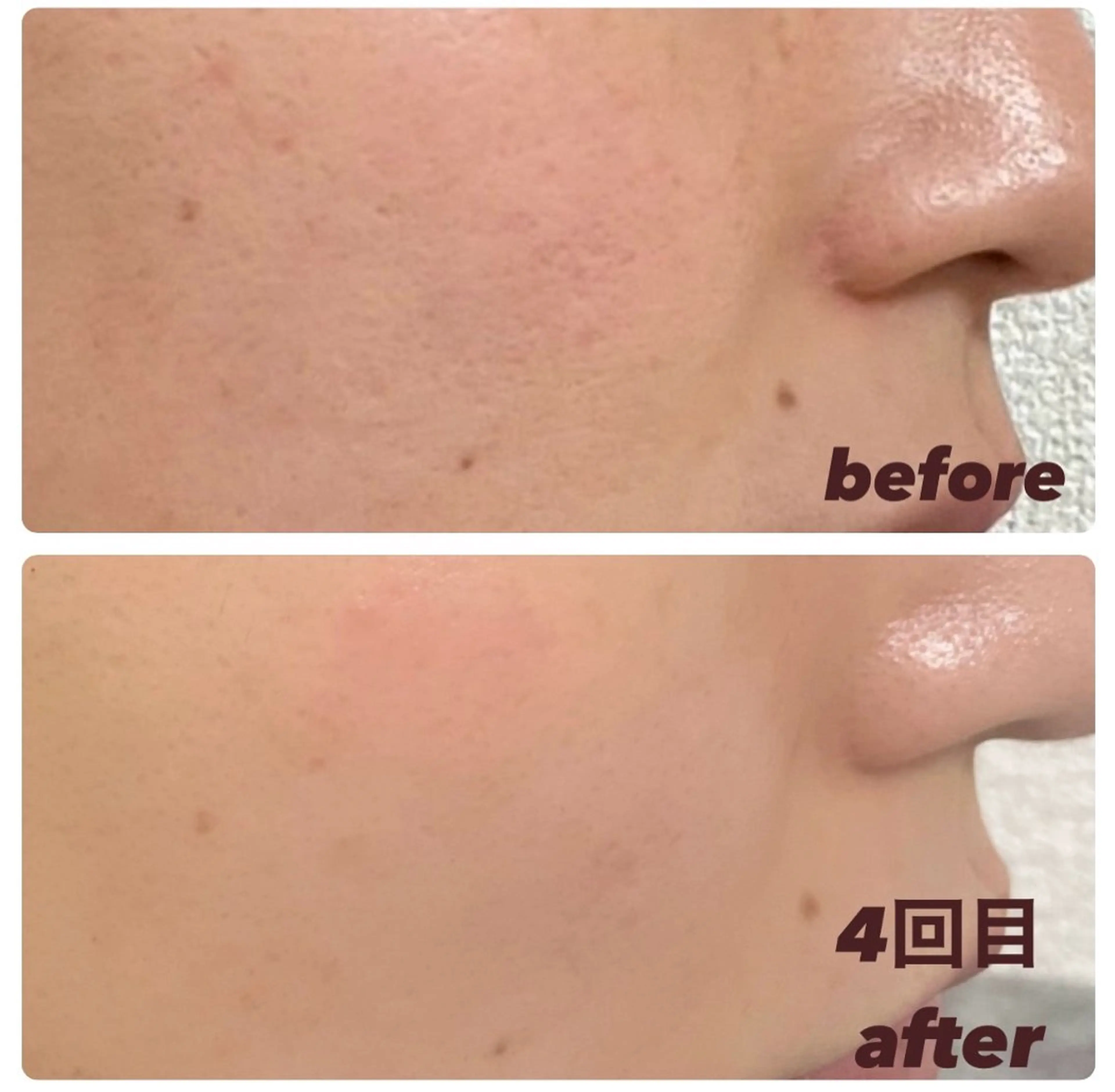 エステ terhibur 〜テルヒブール〜のエステ・リラクイメージ