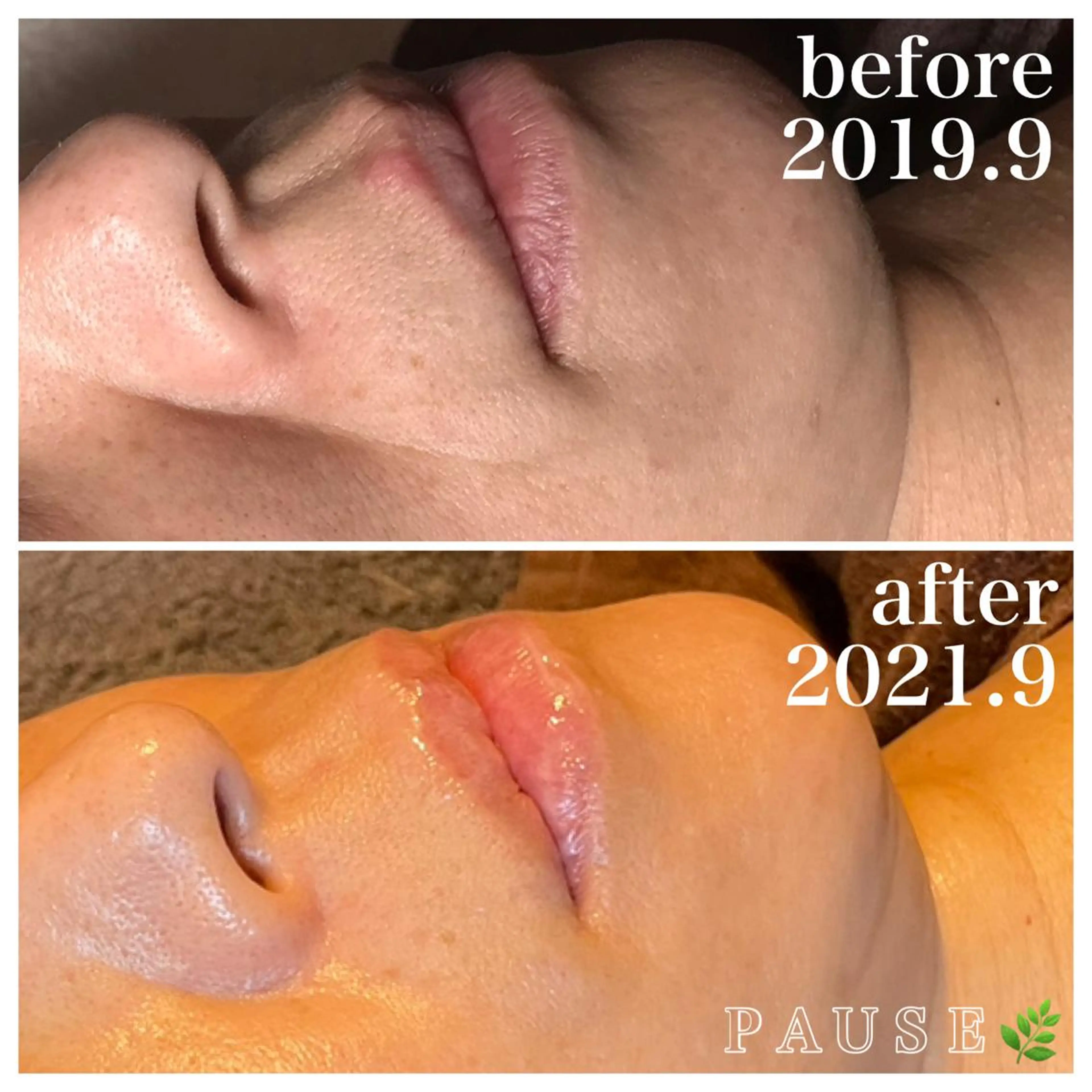 エステ 浜野 恵美のエステ・リラクイメージ