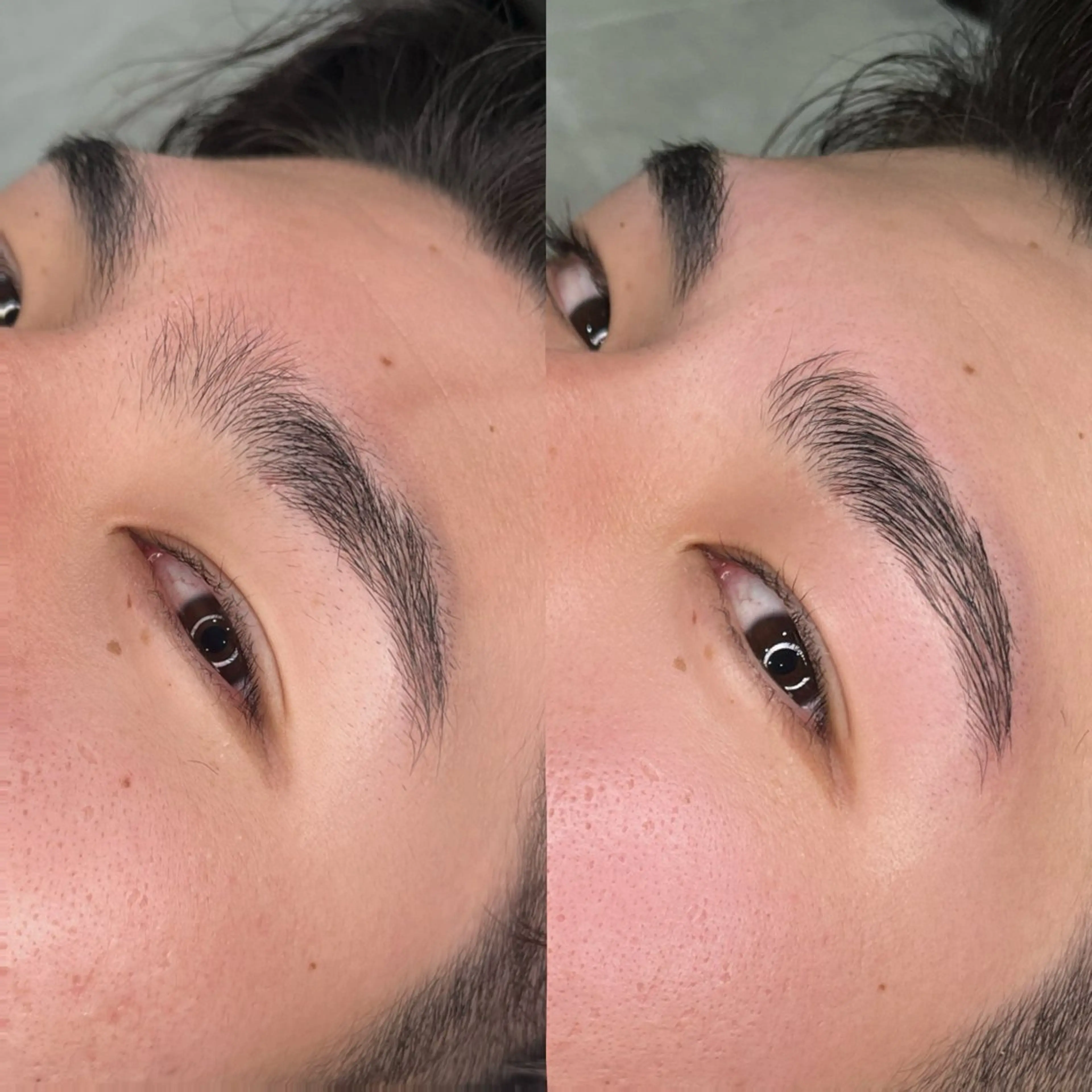 メンズ アイブロウ 脱毛サロンHUGME 光フォトフェイシャルのエステ・リラクイメージ