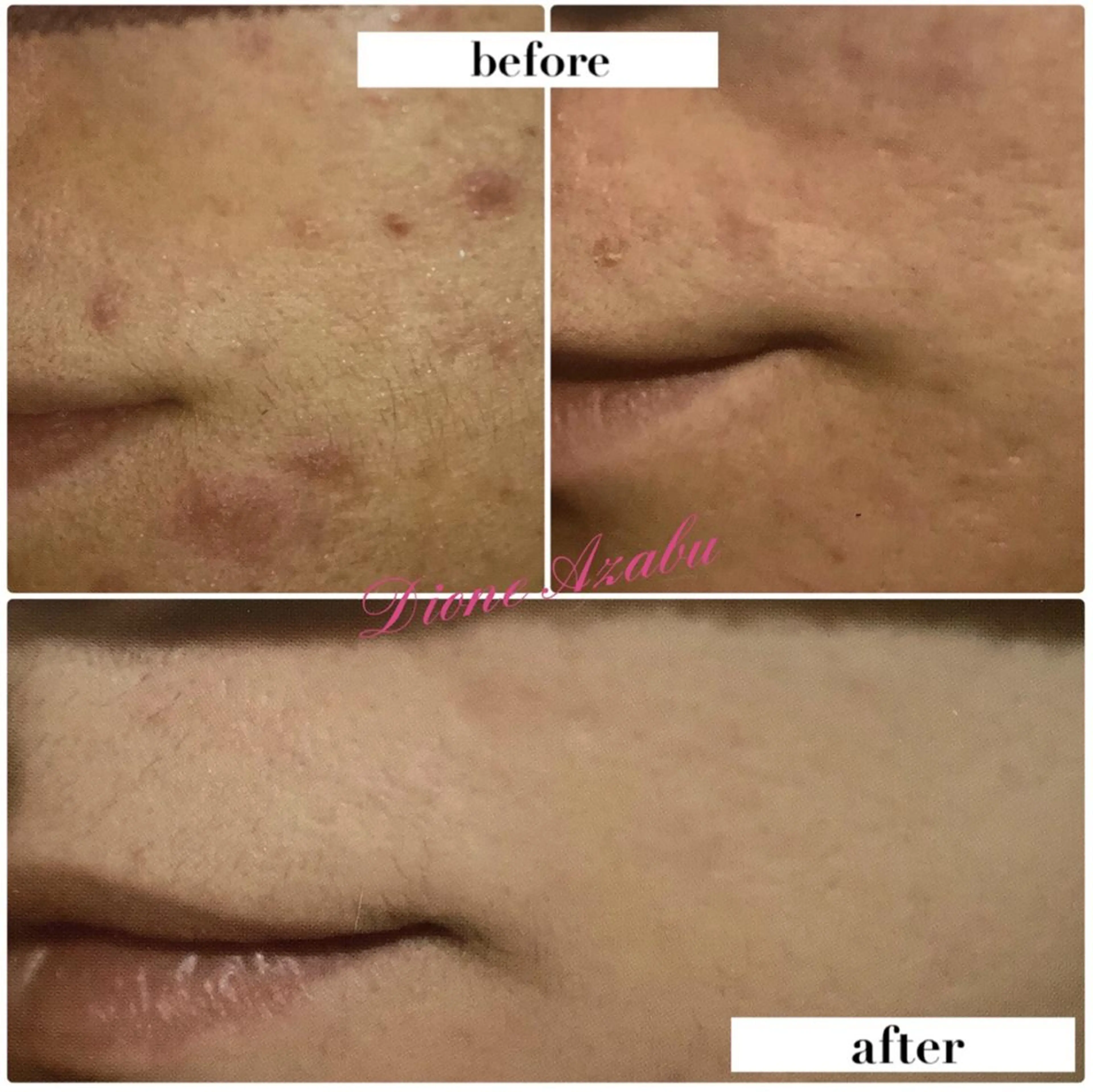 DIONE 麻布十番店のエステ・リラクイメージ