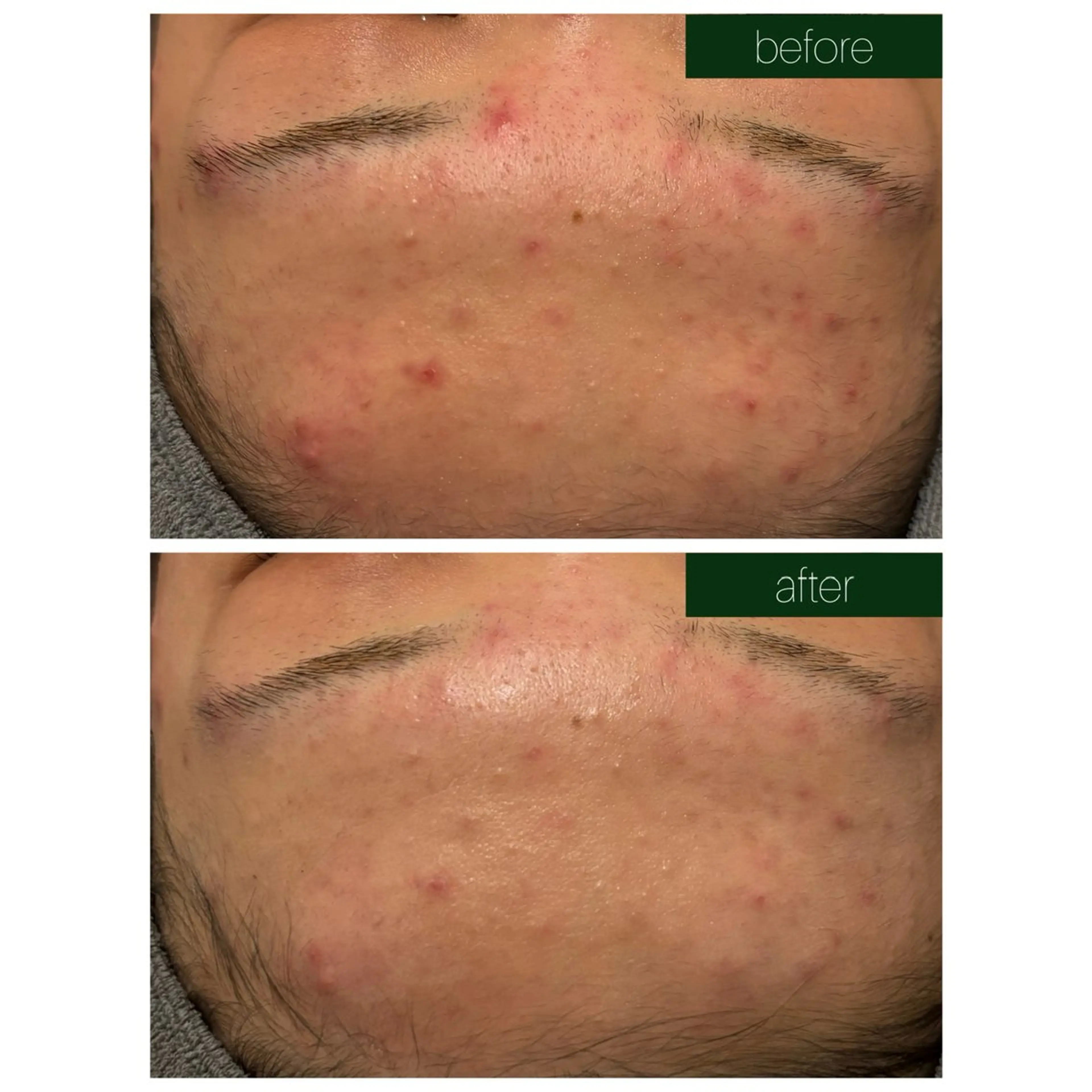 小顔コルギ ☆表参道/外苑前のエステ・リラクイメージ