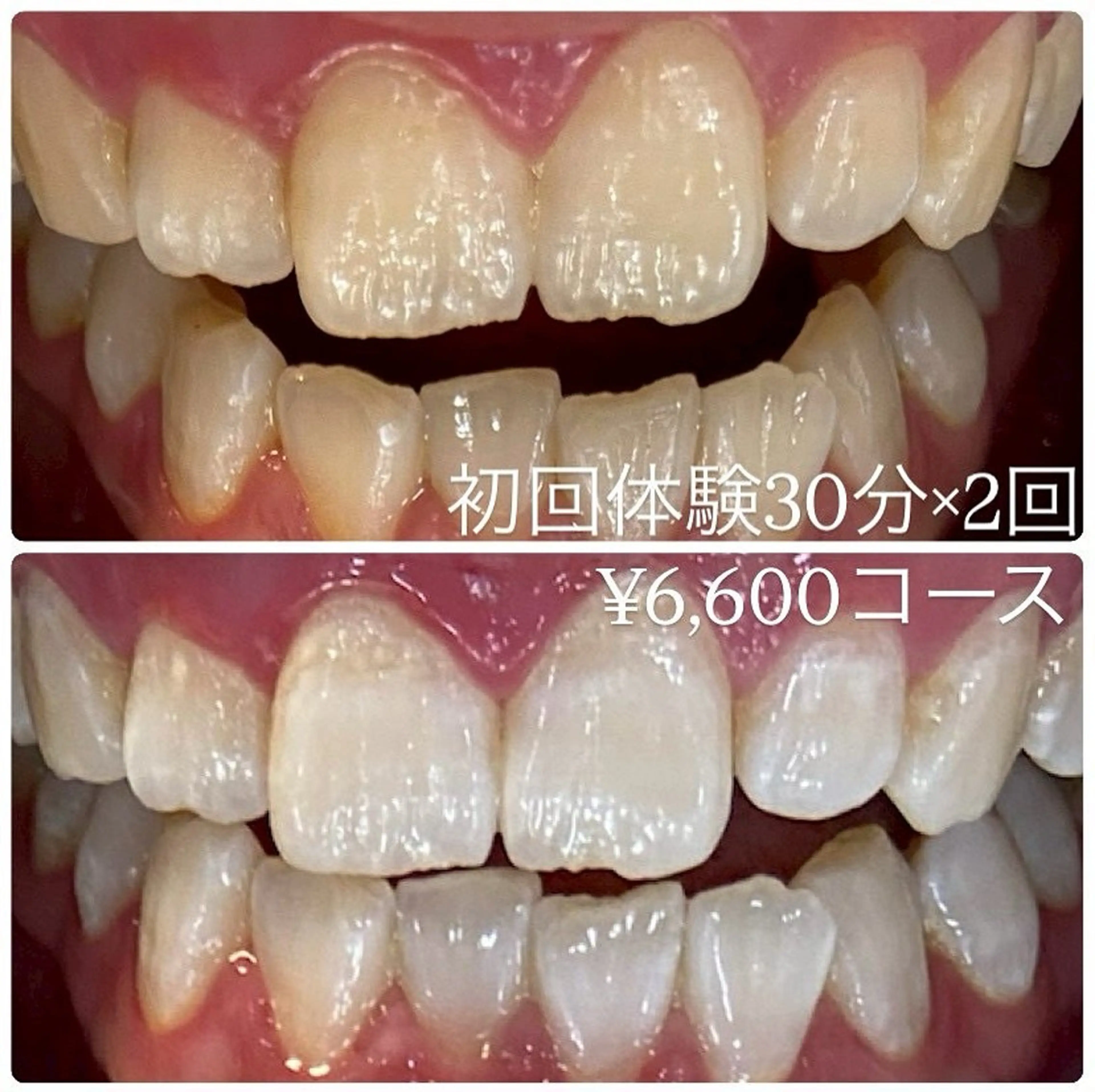 その他 PLATINUM Beauty 横浜店所属・ホワイトニングルーム 横浜店のその他イメージ