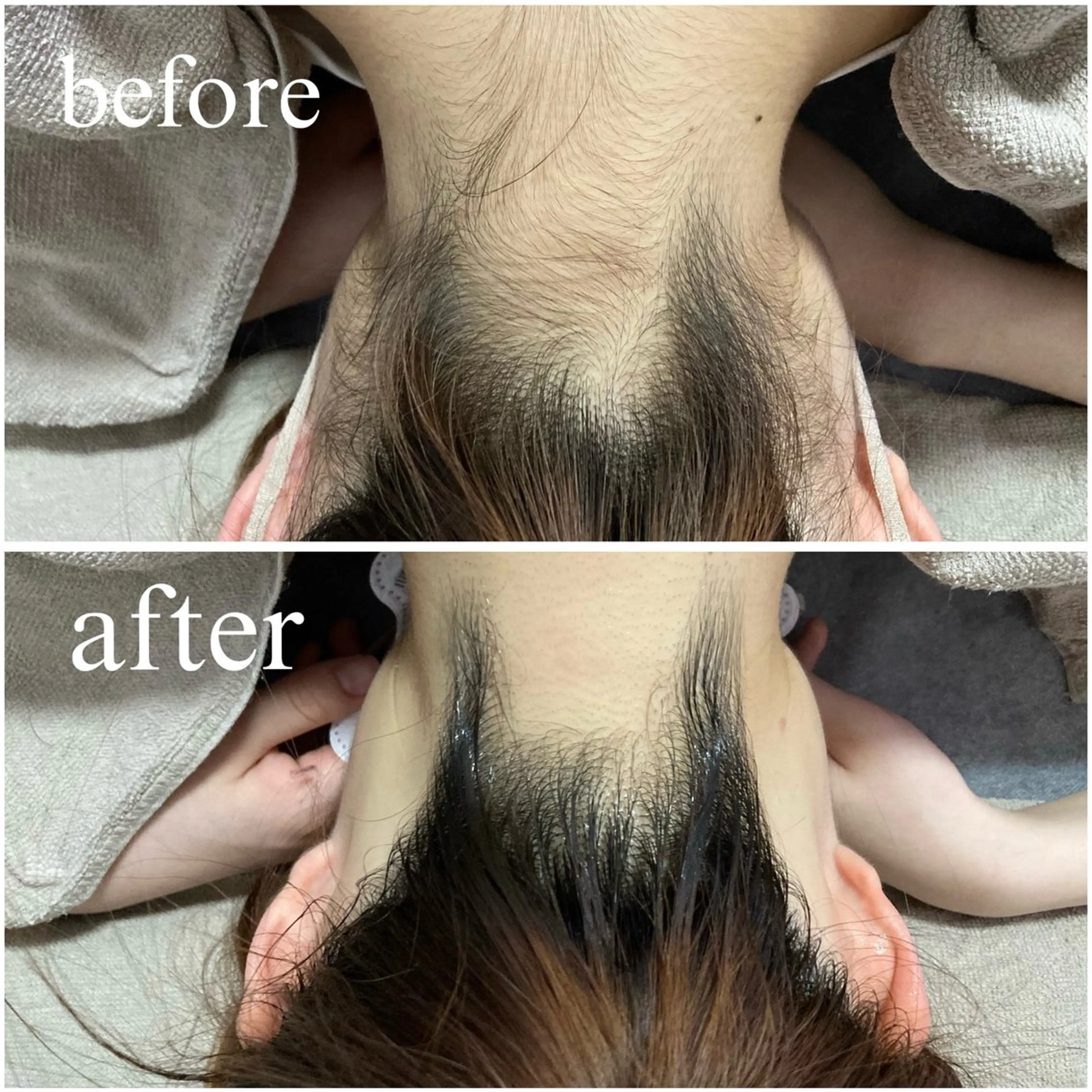 【韓国肌管理・脱毛】 クレセントのその他イメージ