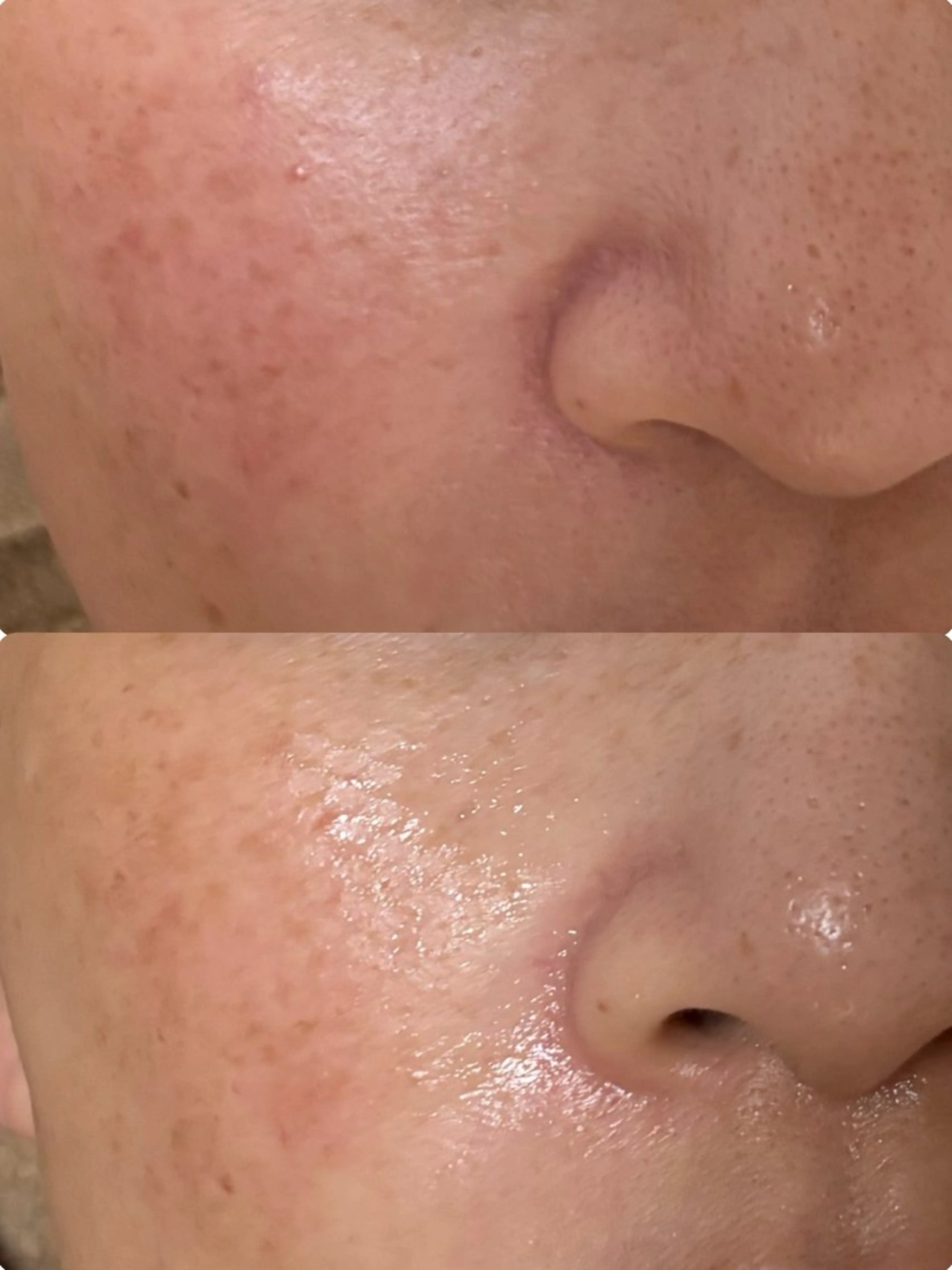 mire（ミレ） トータルビューティーの眉毛・アイブロウイメージ