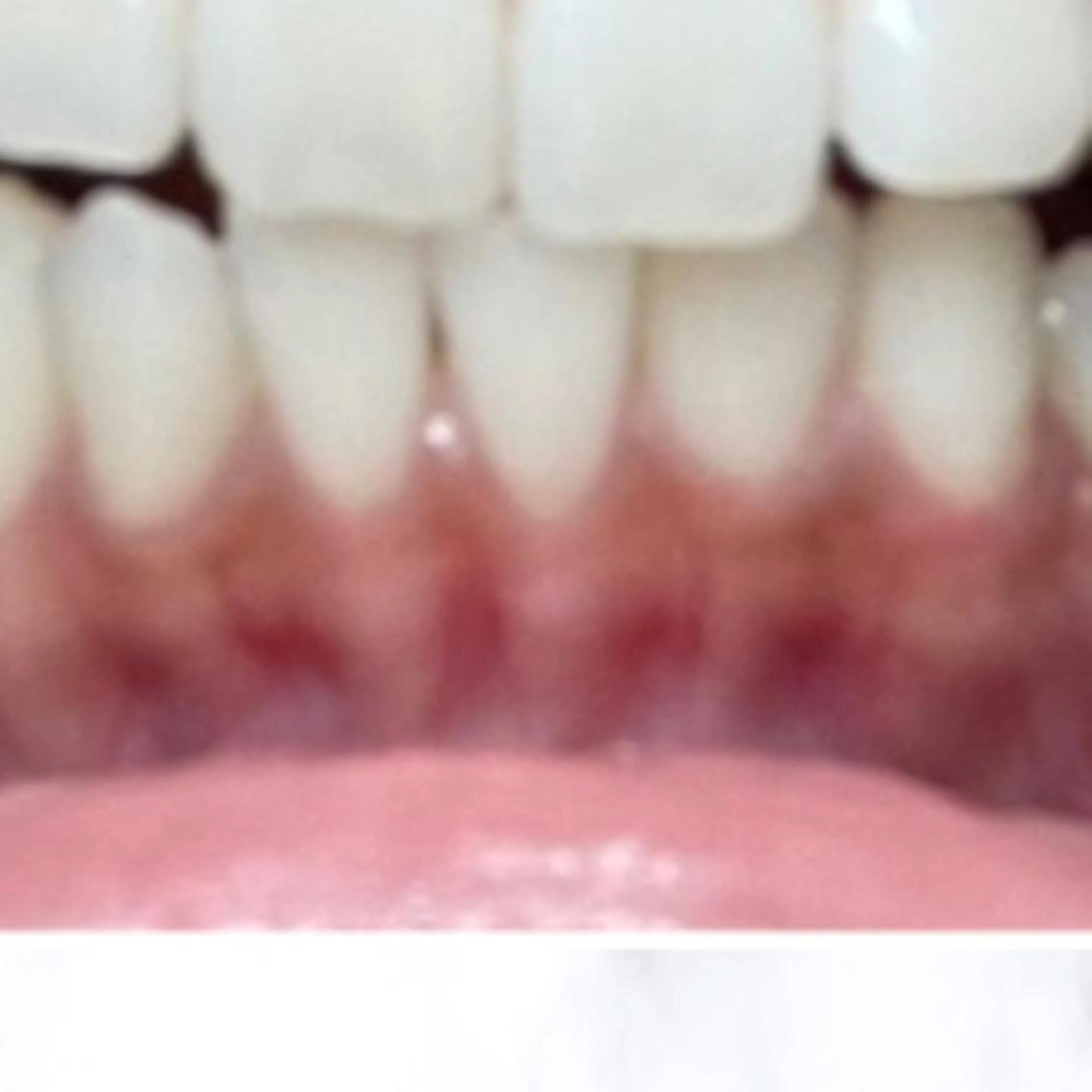 その他 ライトケアサロン 渋谷店② 渡邊のその他イメージ