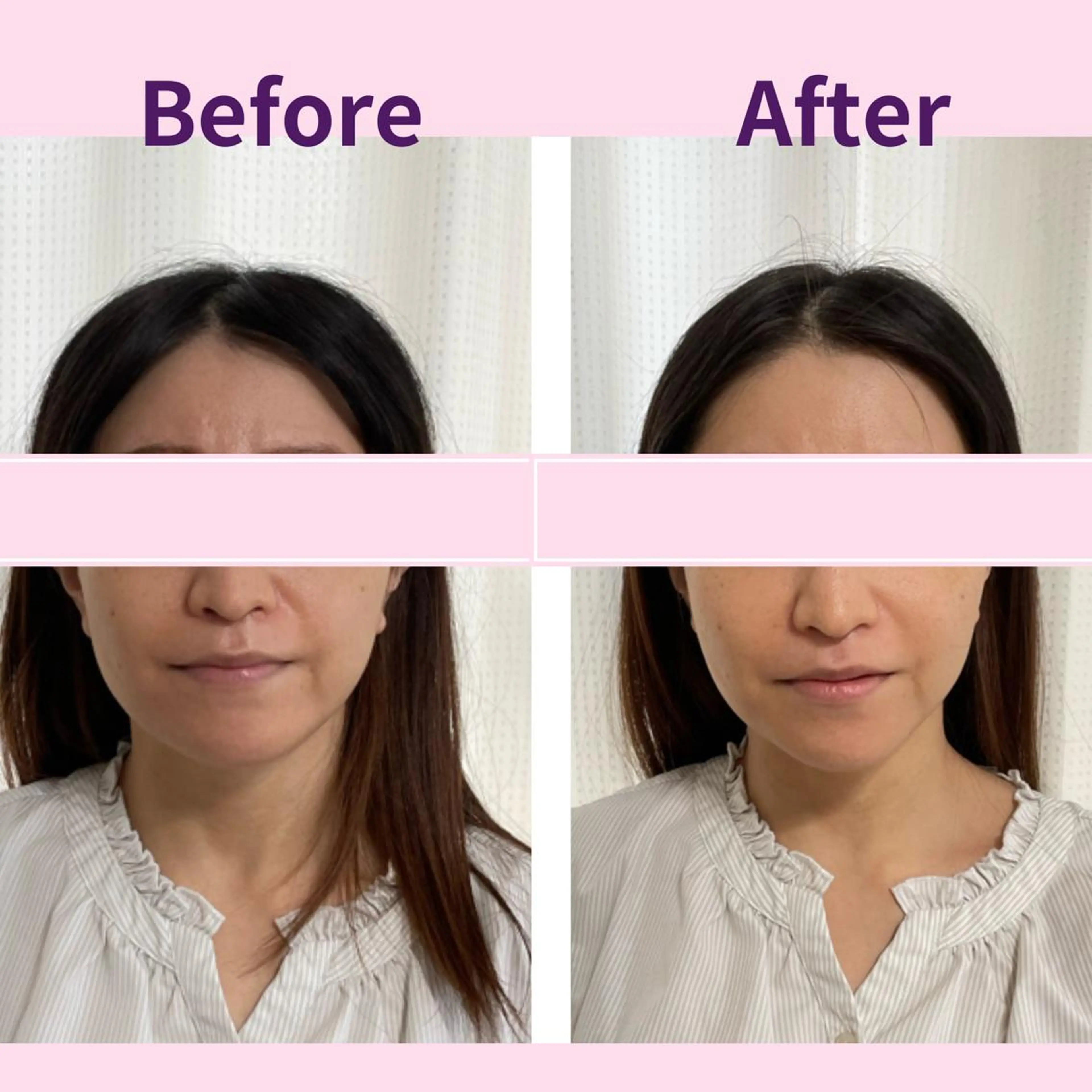 小顔エステサロン ハピハピのエステ・リラクイメージ