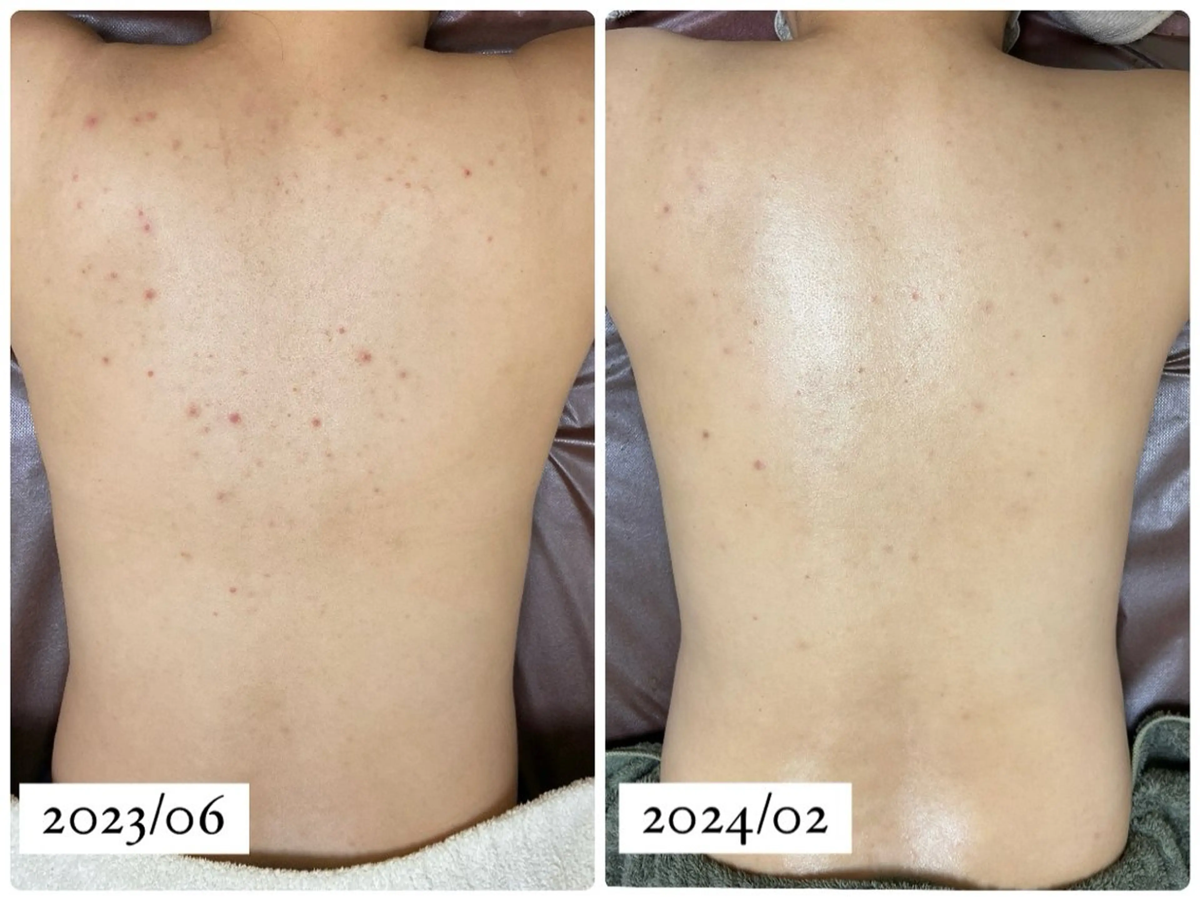 エステ REBORN by ami-goのその他イメージ