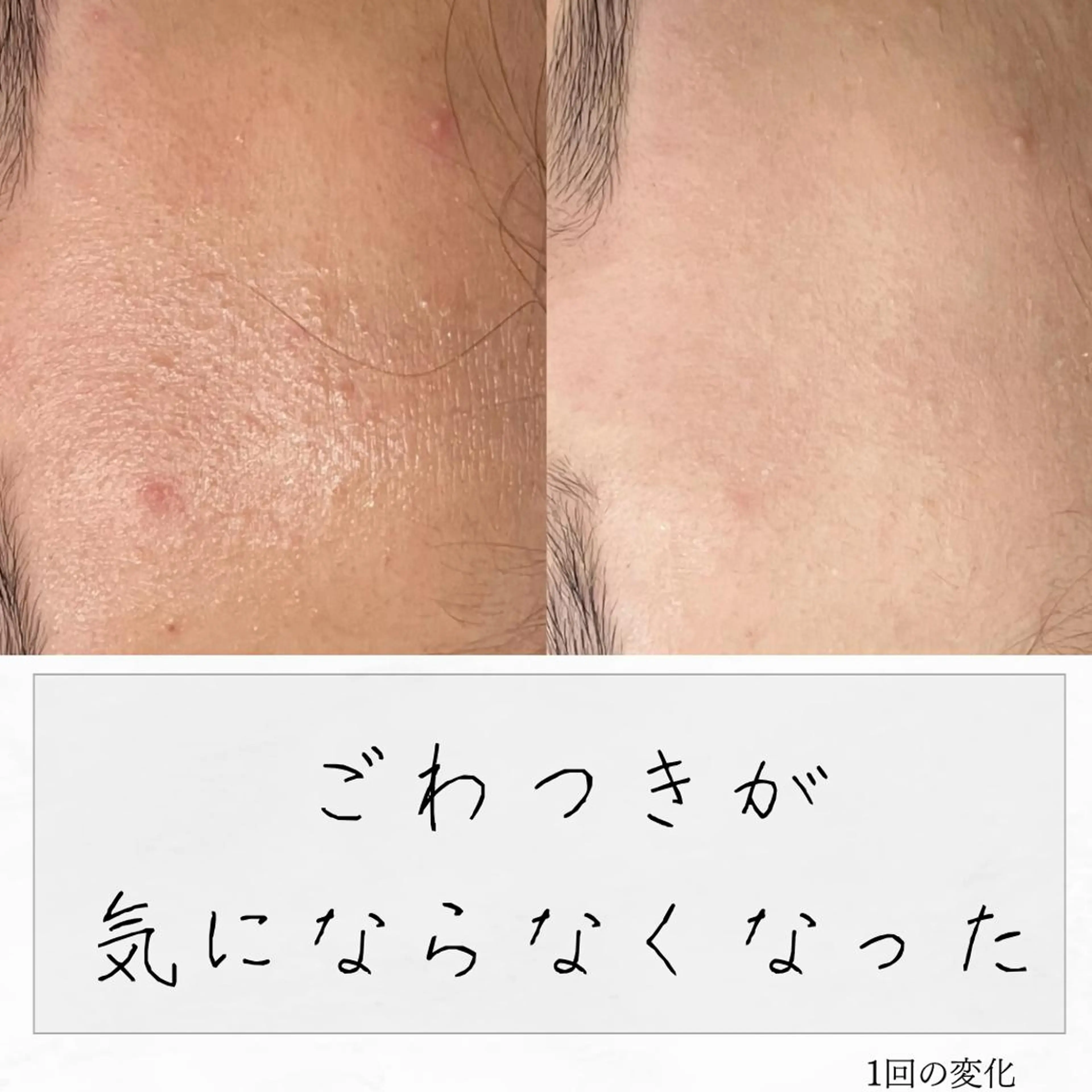 ニキビ経験者が施術 する専門サロン🌻のエステ・リラクイメージ