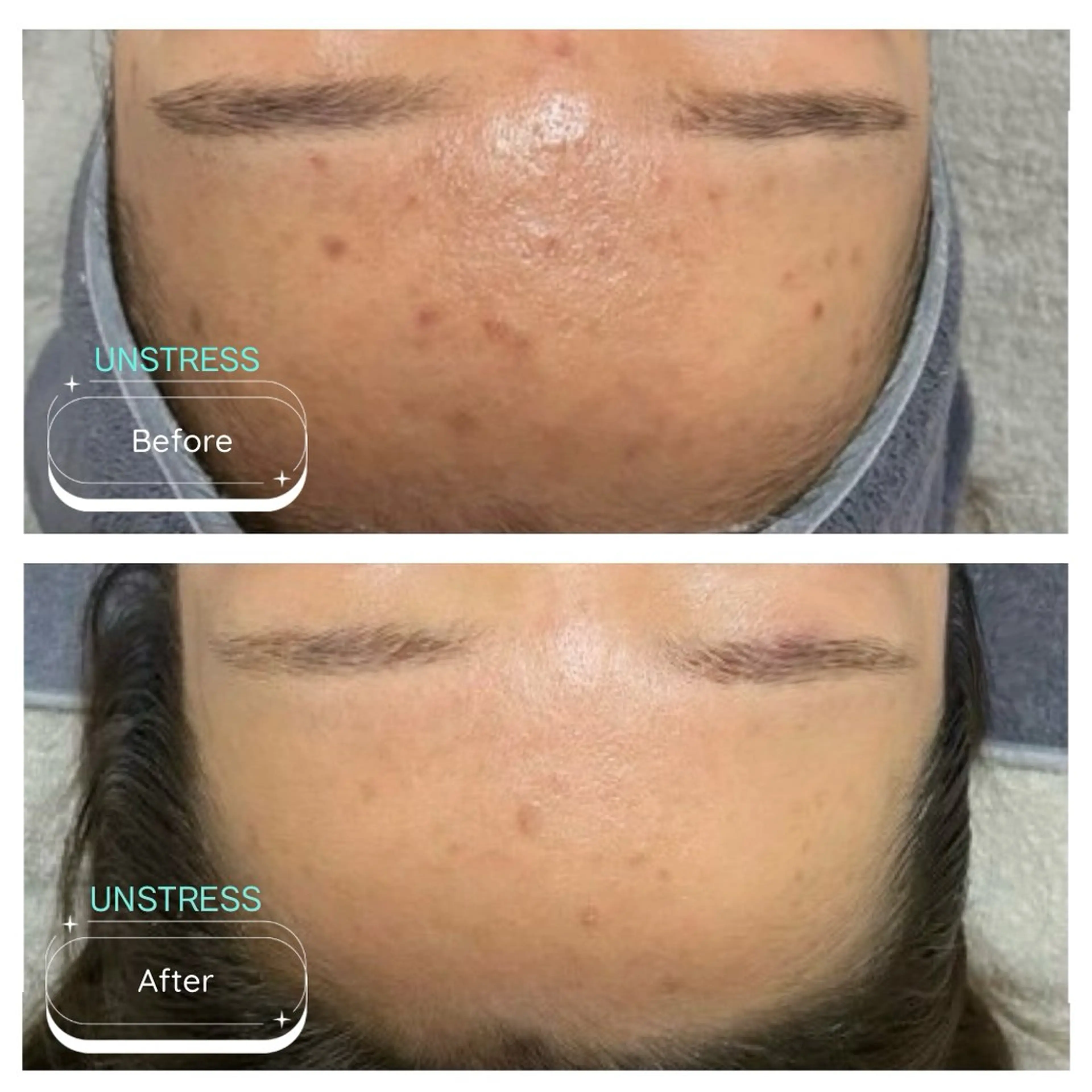 エステ 韓国風eyelush 眉毛サロン/Suuの眉毛・アイブロウイメージ