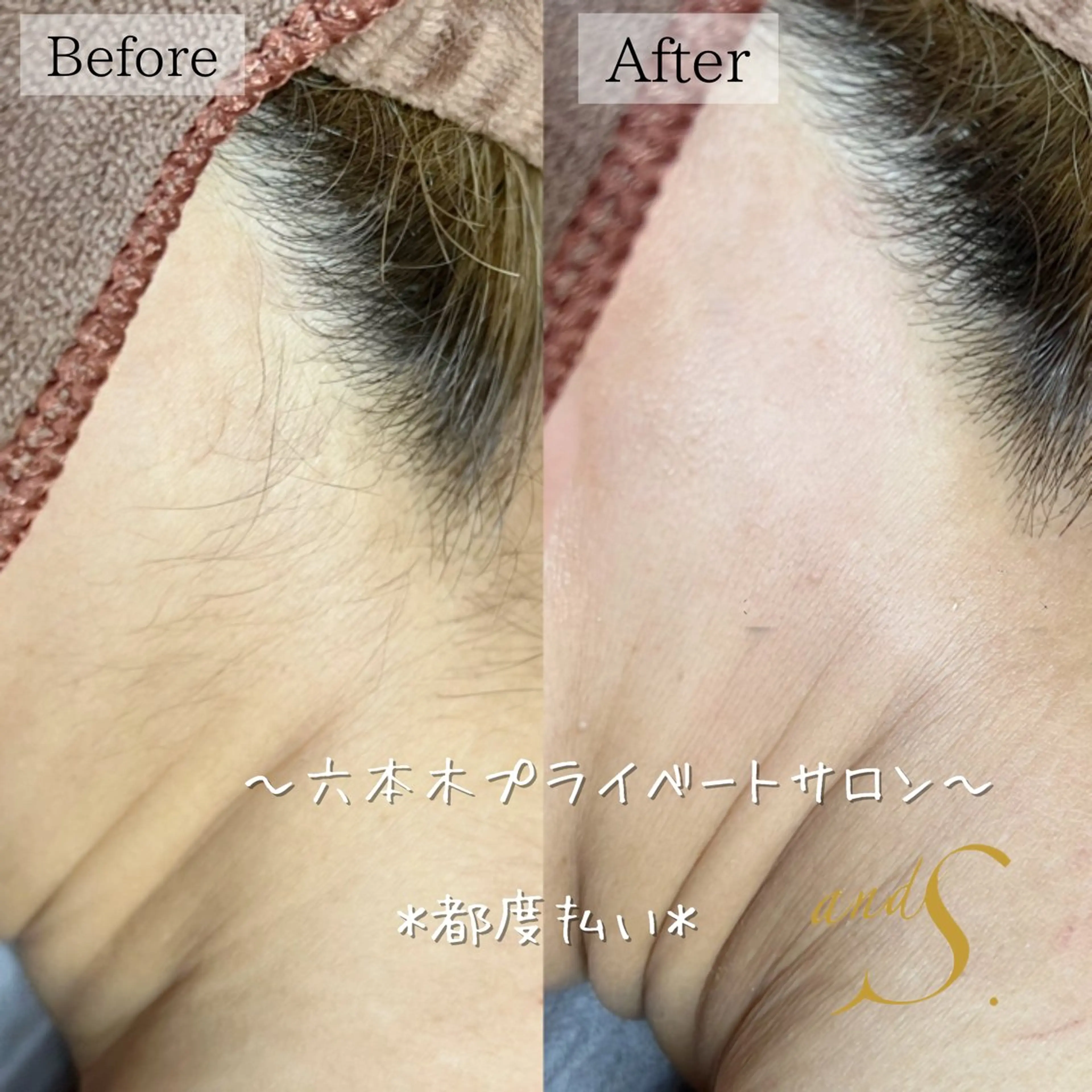 🌸🧡六本木 脱毛しずか🧡🫧の眉毛・アイブロウイメージ