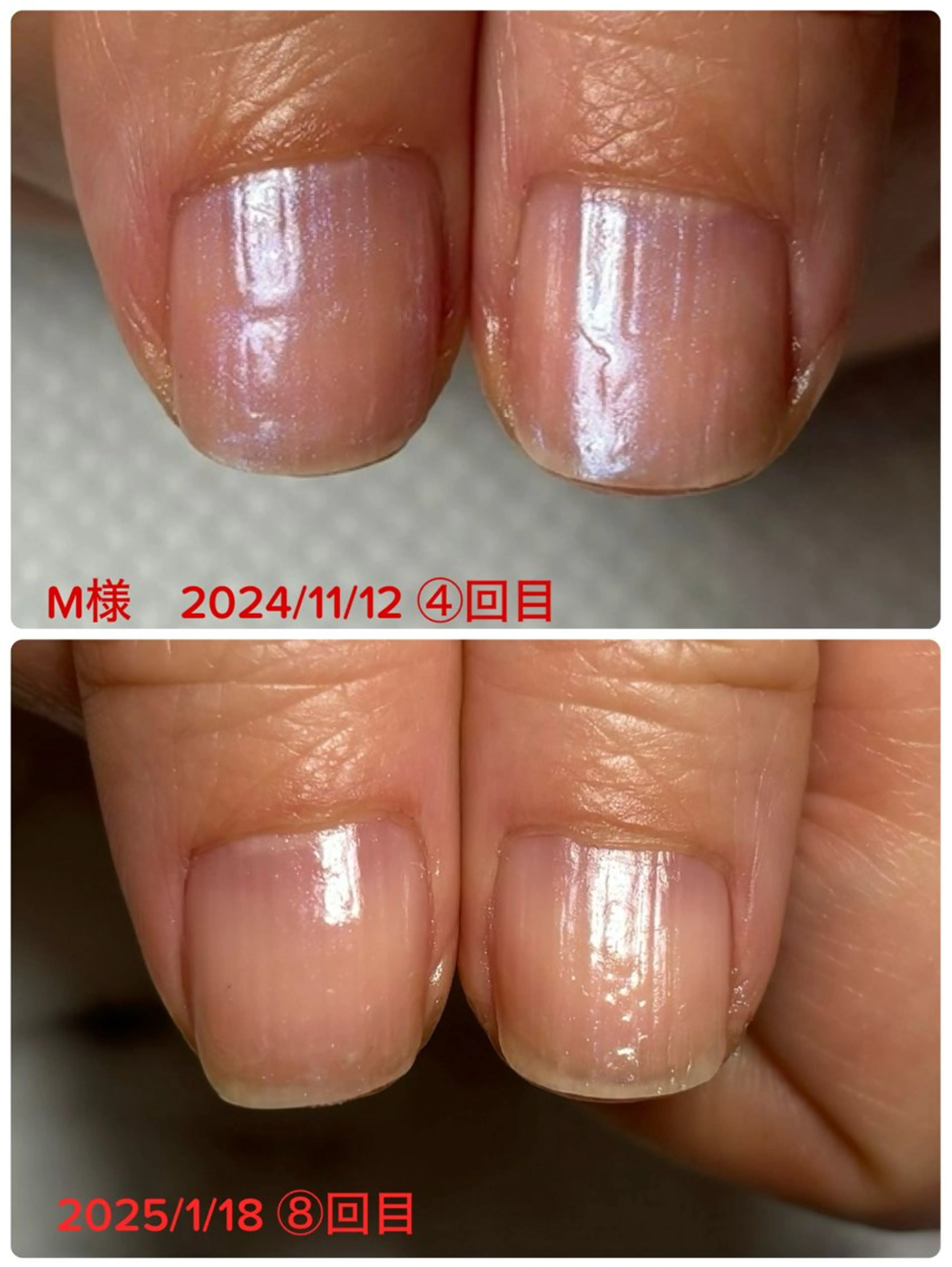 ネイル 自爪育成/深爪矯正salon fam_【ネイルケア・エステ脱毛】所属・自爪育成/深爪矯正 salon fam_のネイルデザイン