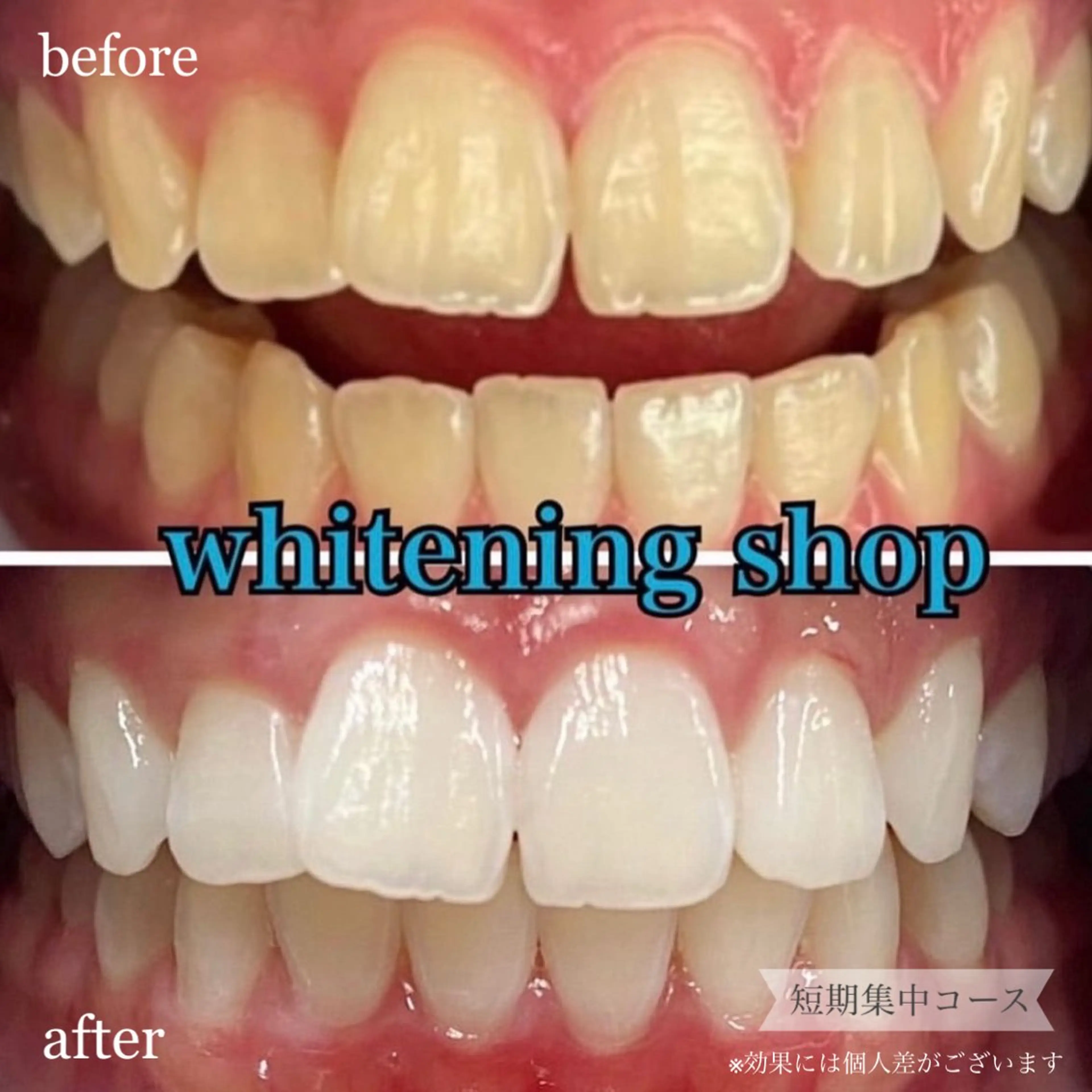 その他 ホワイトニングショップ桜木町店所属・ホワイトニング ショップ桜木町店のエステ・リラクイメージ