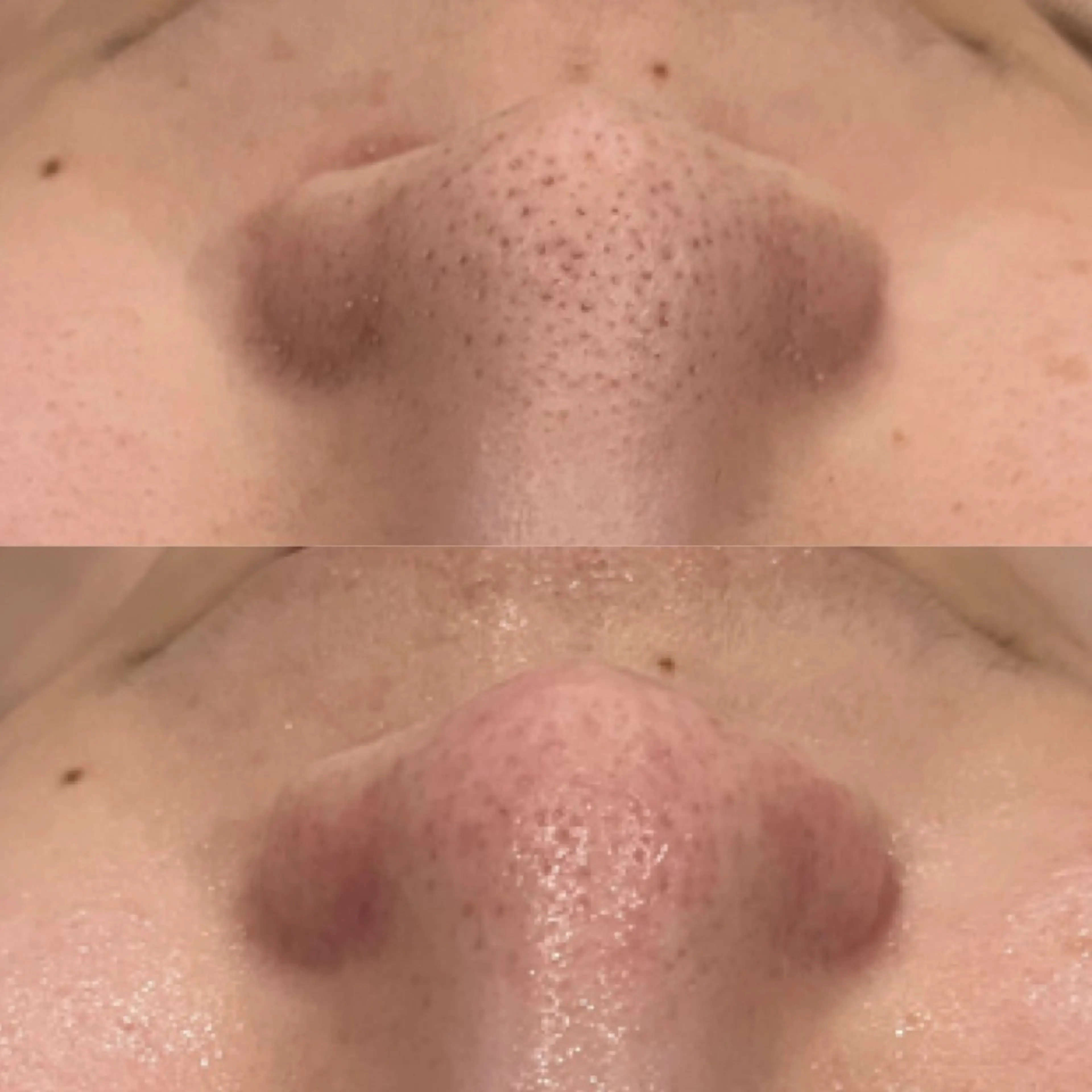 【しみ毛穴専門店】beautysalon Ankh所属・しみ毛穴専門店 Ankh 平田のエステ・リラクイメージ