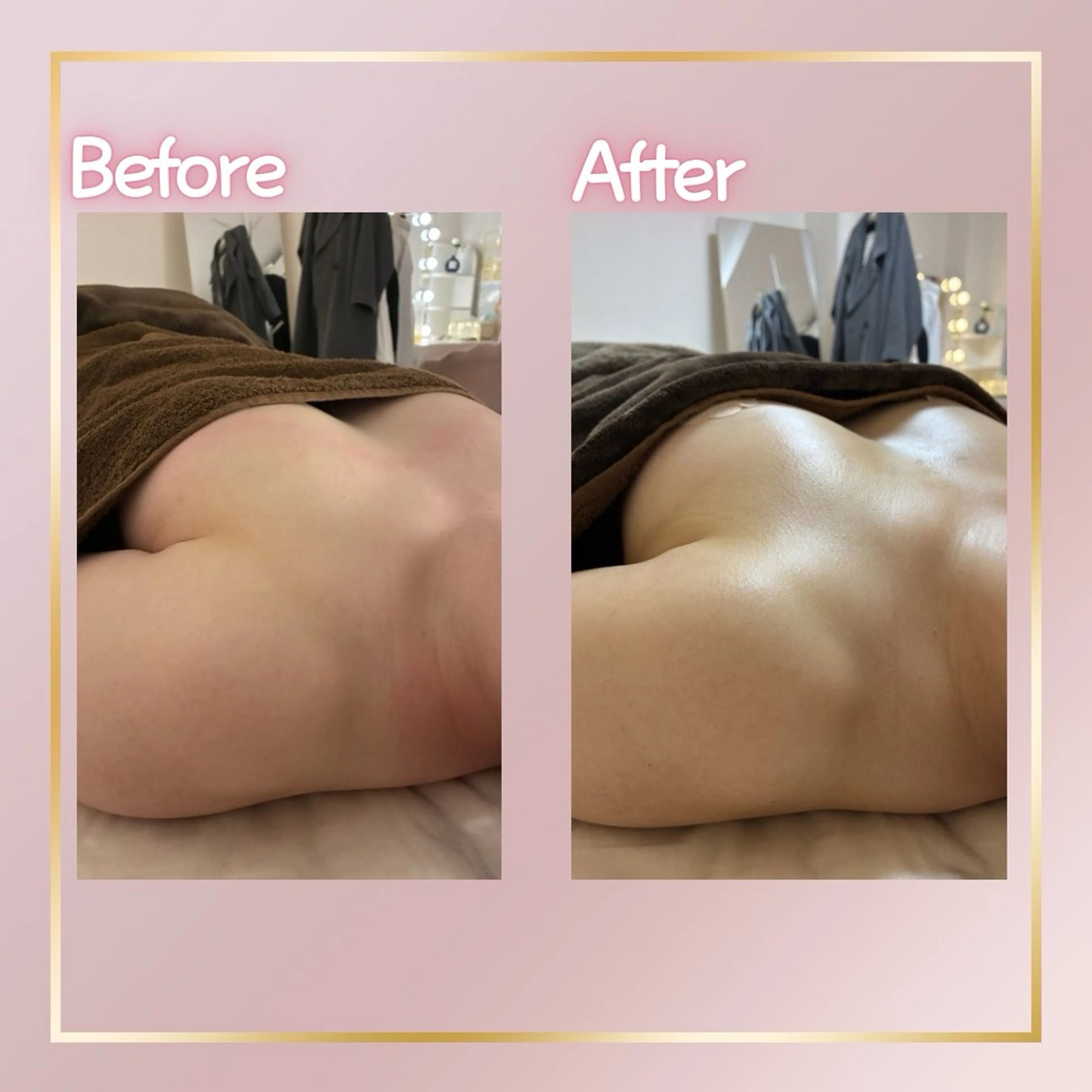 その他 最新育乳マシン使用！ バストアップ専門店のその他イメージ