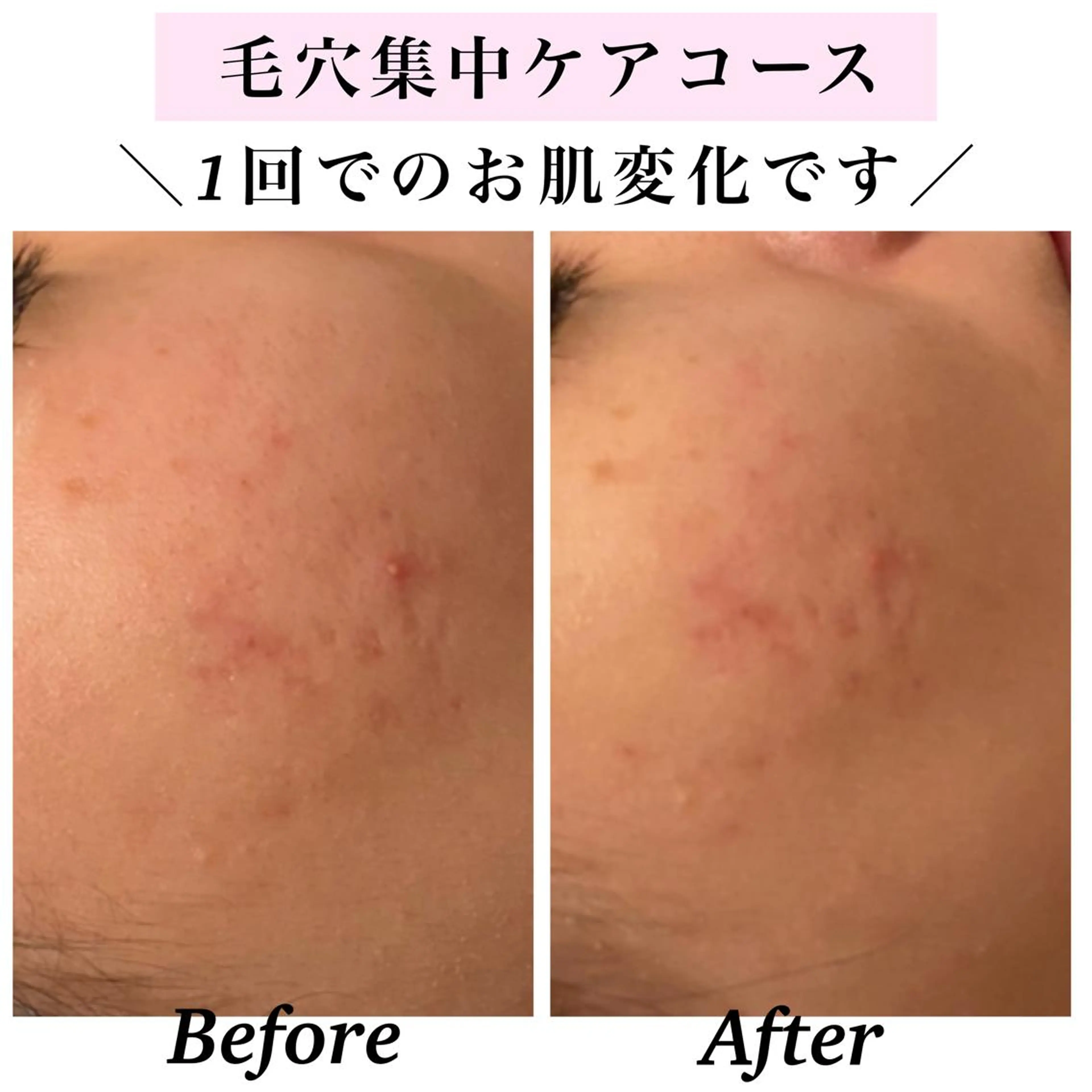 エステ リラク Bellesthe （ベルエステ）のエステ・リラクイメージ