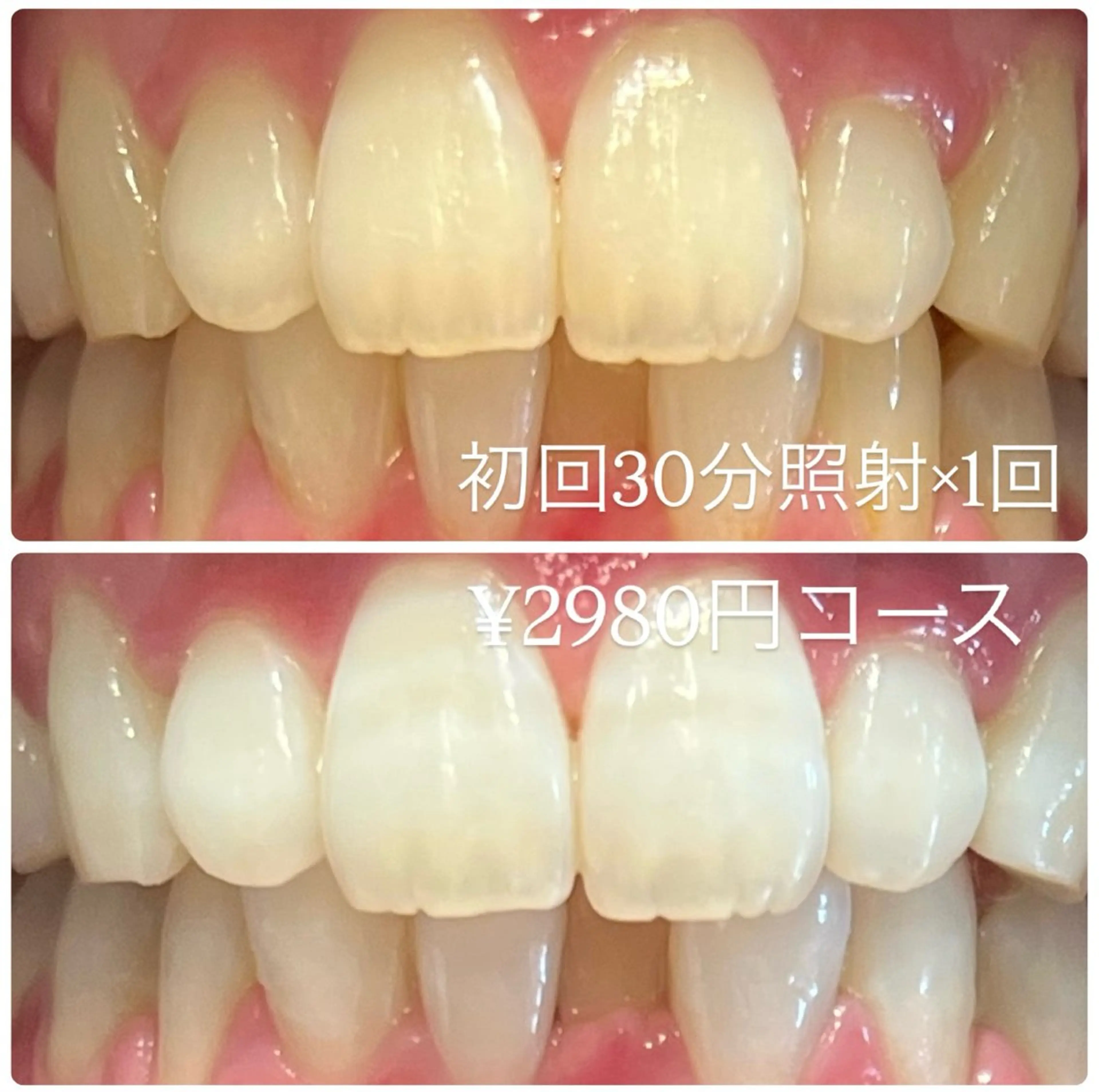 その他 ホワイトニングルーム 横浜店のその他イメージ