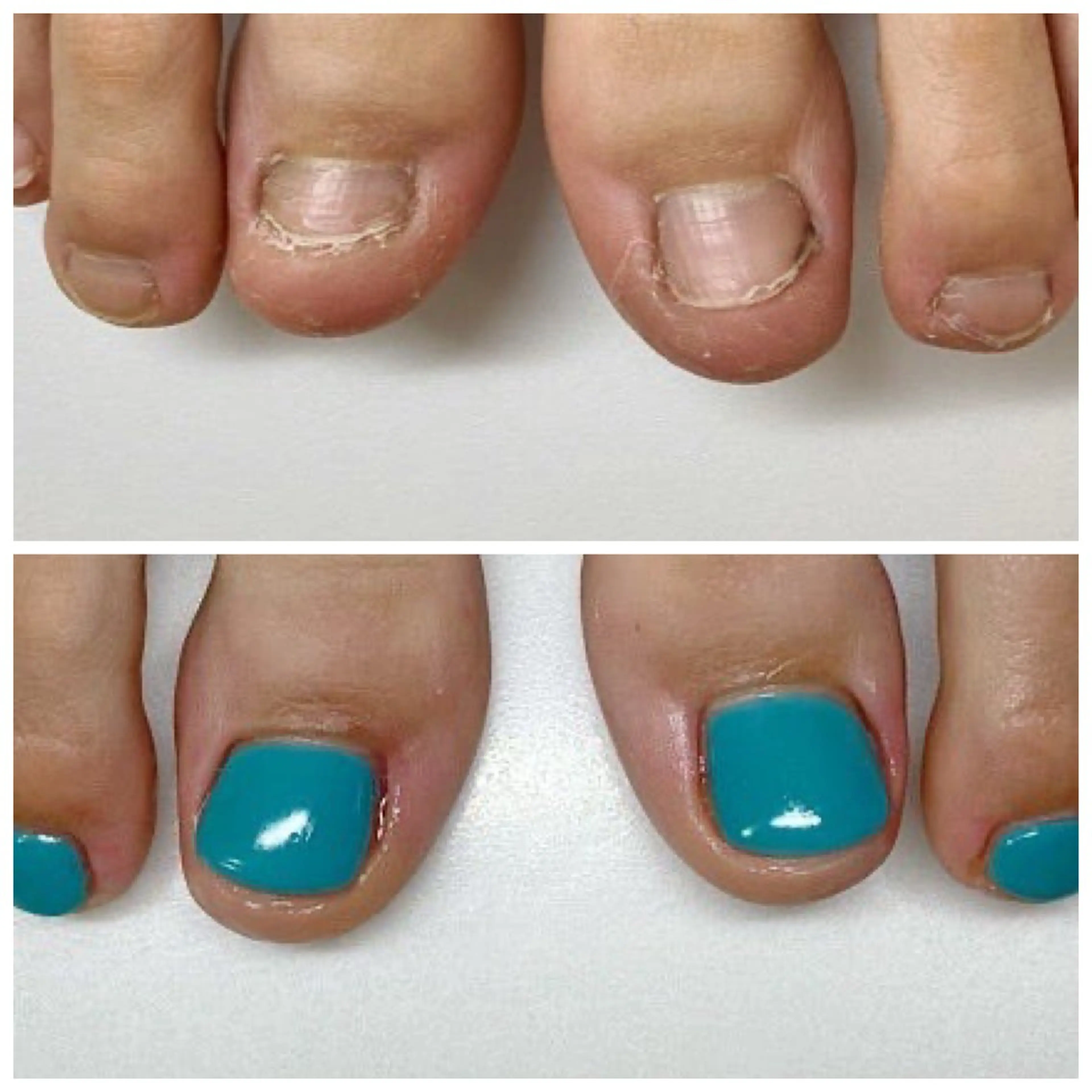 ネイル フットネイル ネイルサロンアリューム所属・ネイルサロン アリュームのネイルデザイン