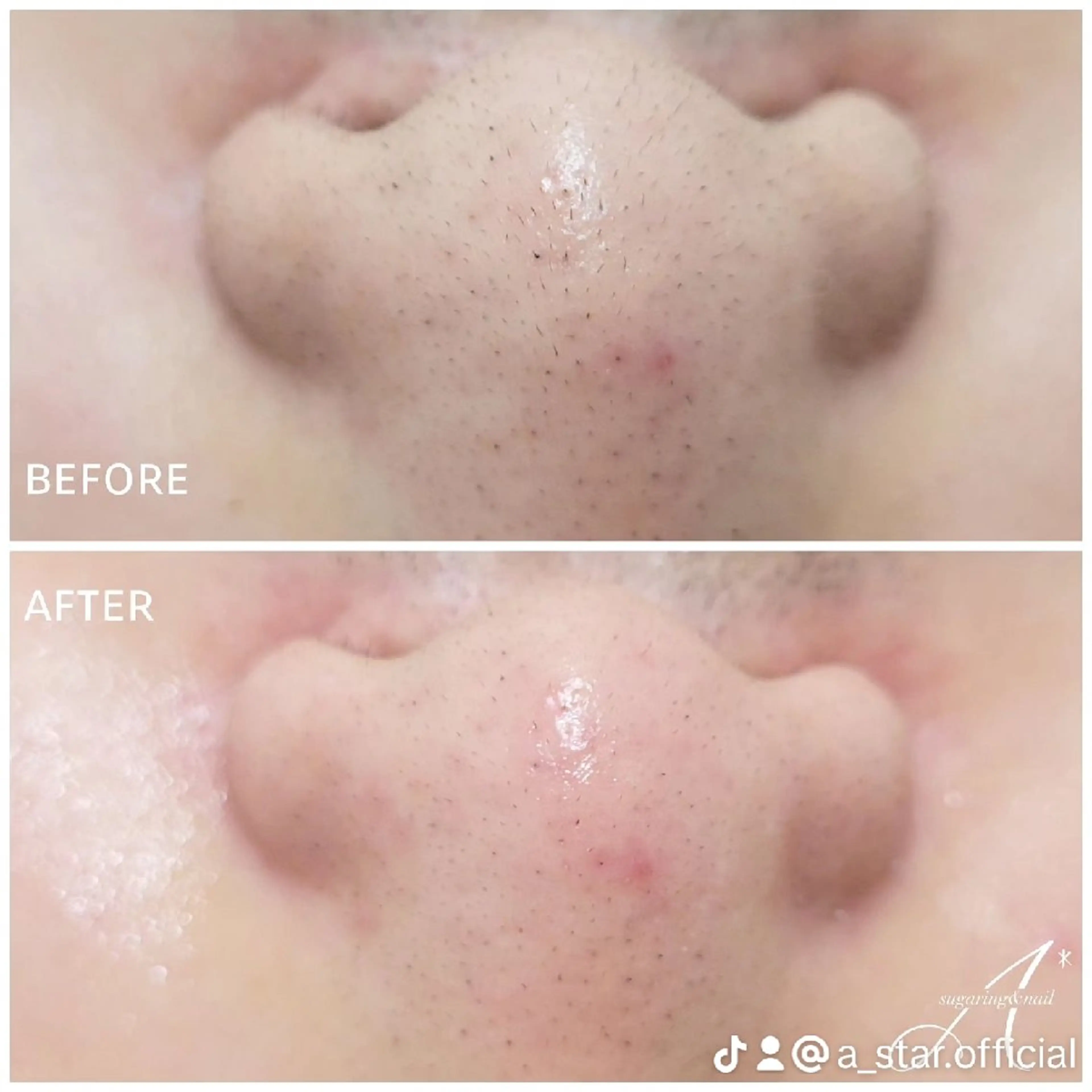 その他 A*《エースター》 シュガーリング🍋のエステ・リラクイメージ