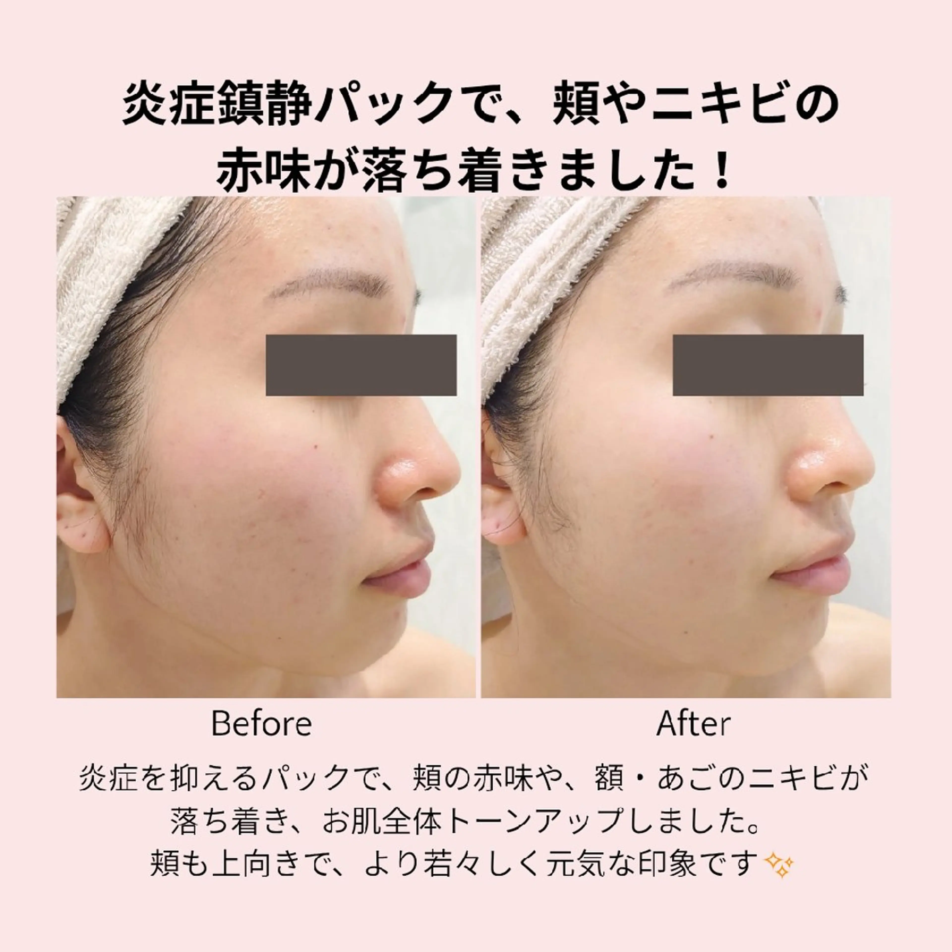 エステ PRETTIEST SHINE所属・フェイシャル/ボディ /ブライダル山田浩子のエステ・リラクイメージ