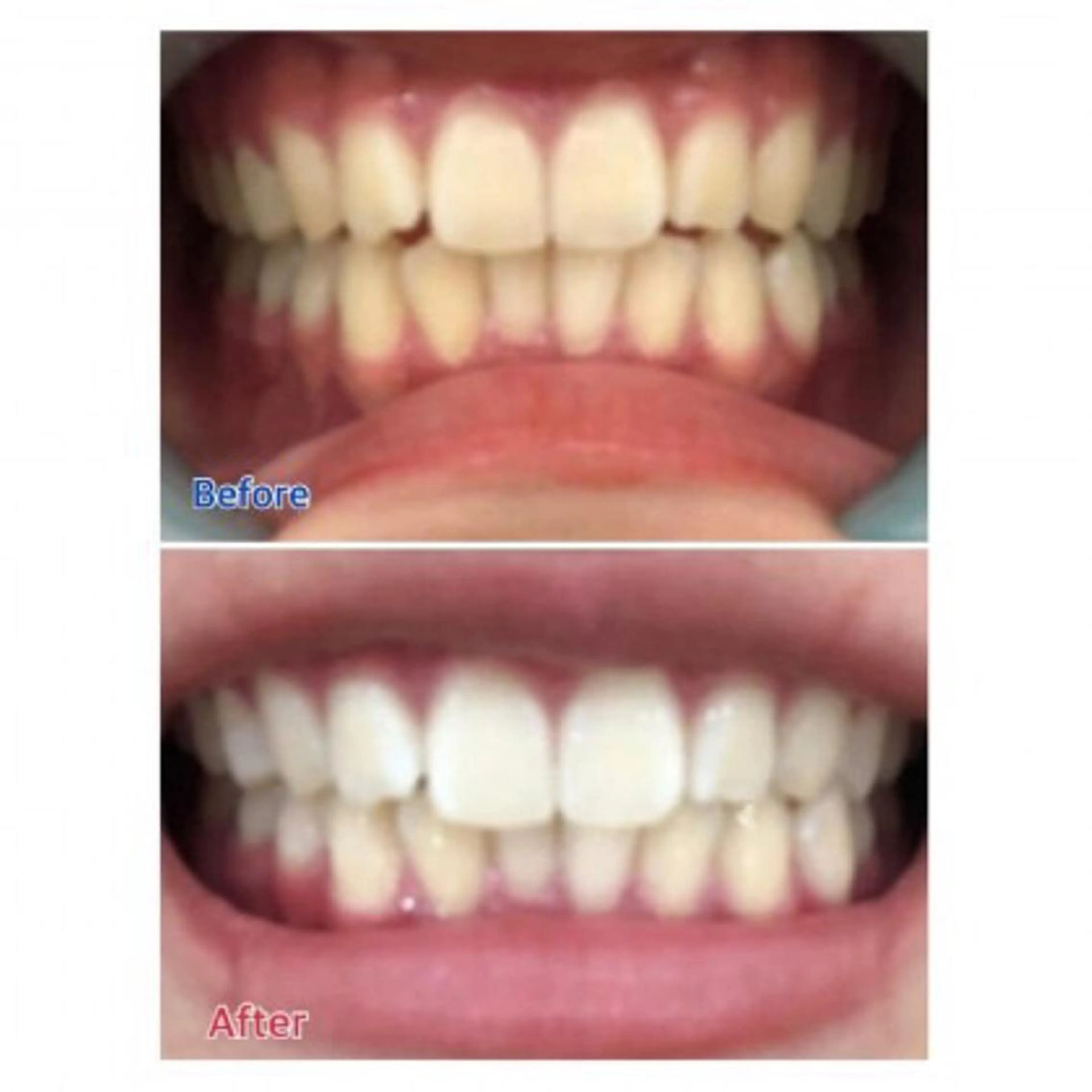 Ｍ渋谷 ホワイトニングのエステ・リラクイメージ