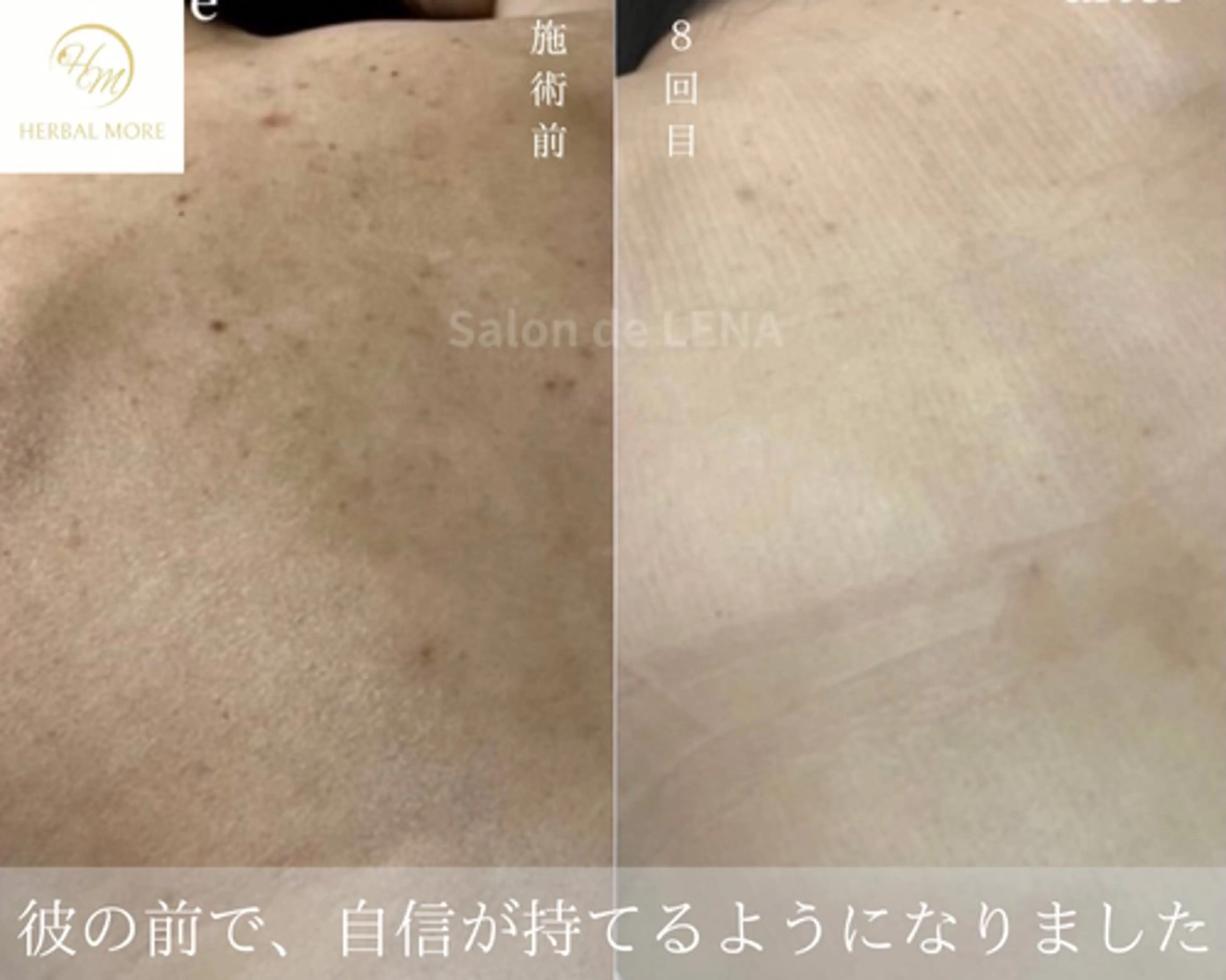 エステ サロンドレナ名駅店所属・ハーブピーリング専門 サロンドレナ平岡のエステ・リラクイメージ