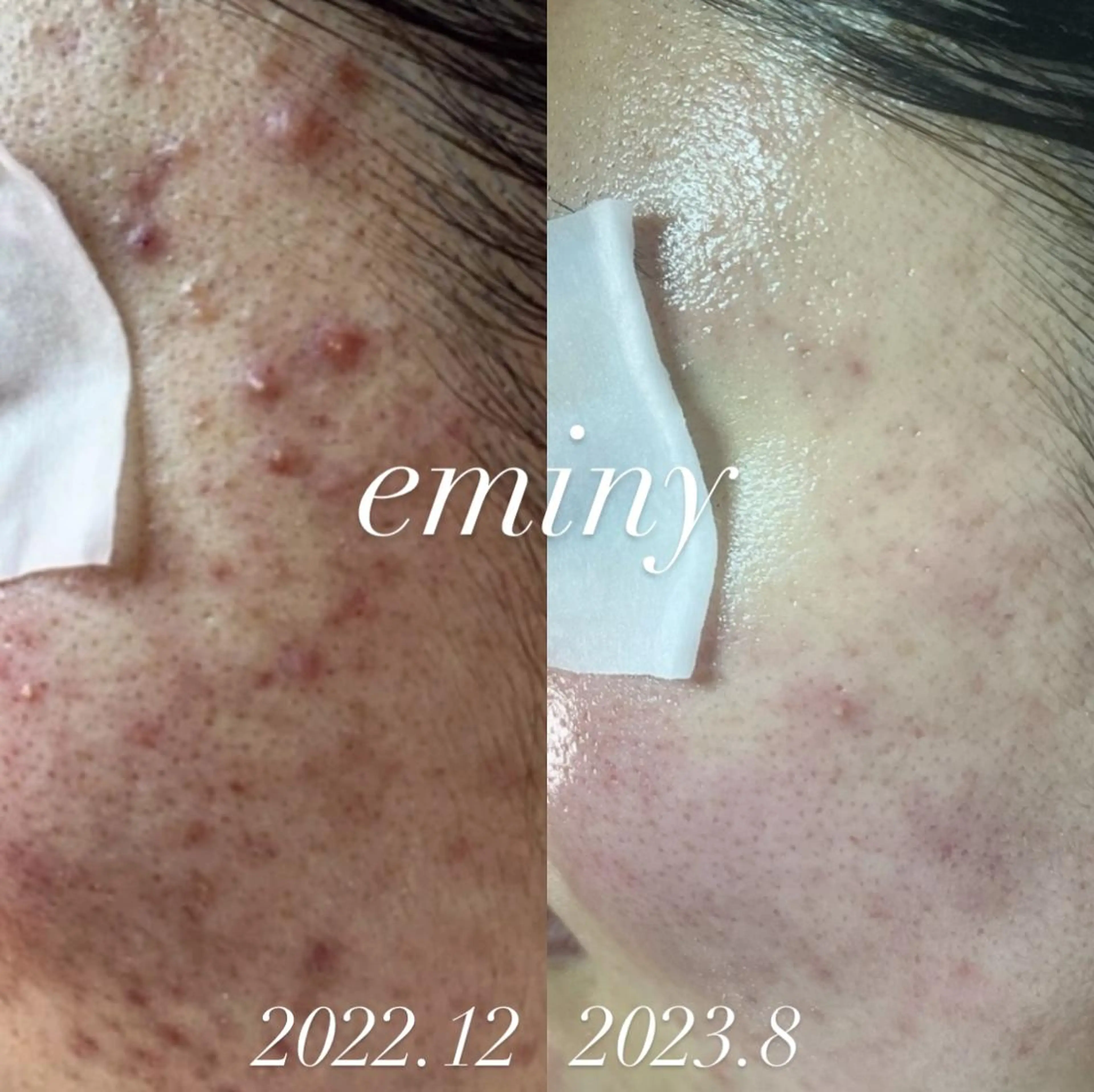 EMINY （エステティシャン）のエステ・リラクイメージ