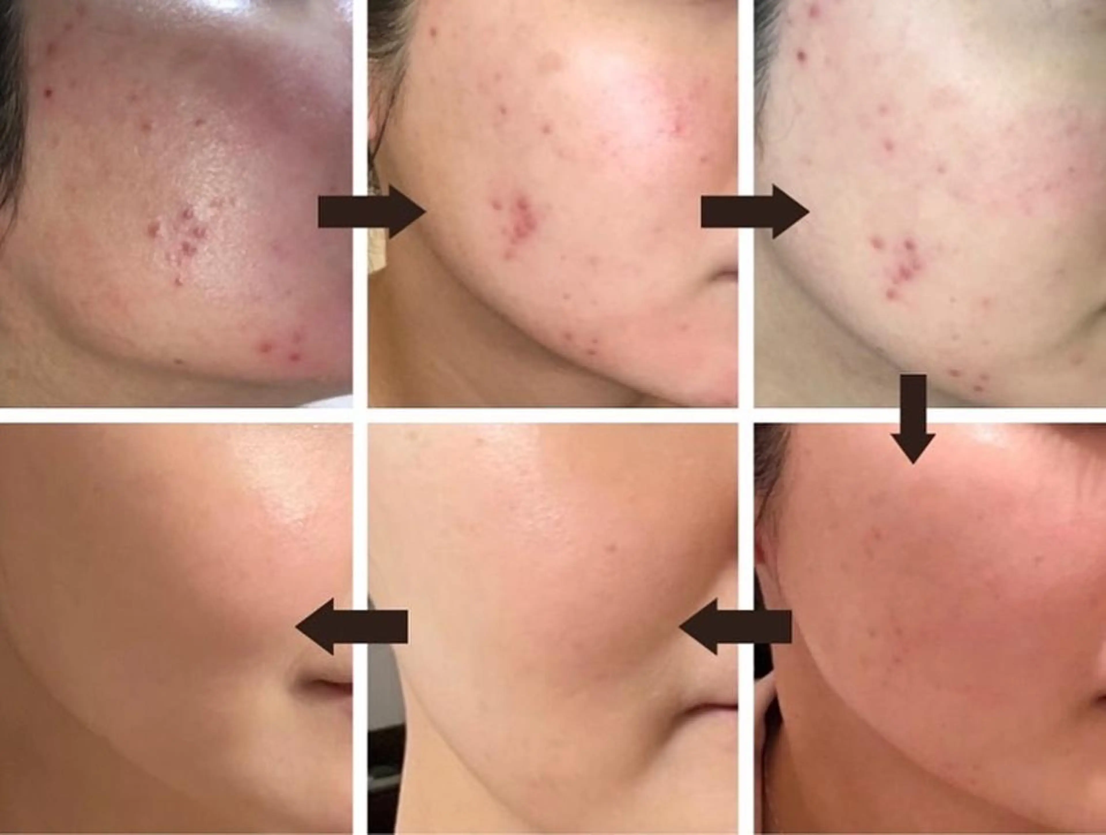 美肌ケアサロン iru【アイル】のエステ・リラクイメージ