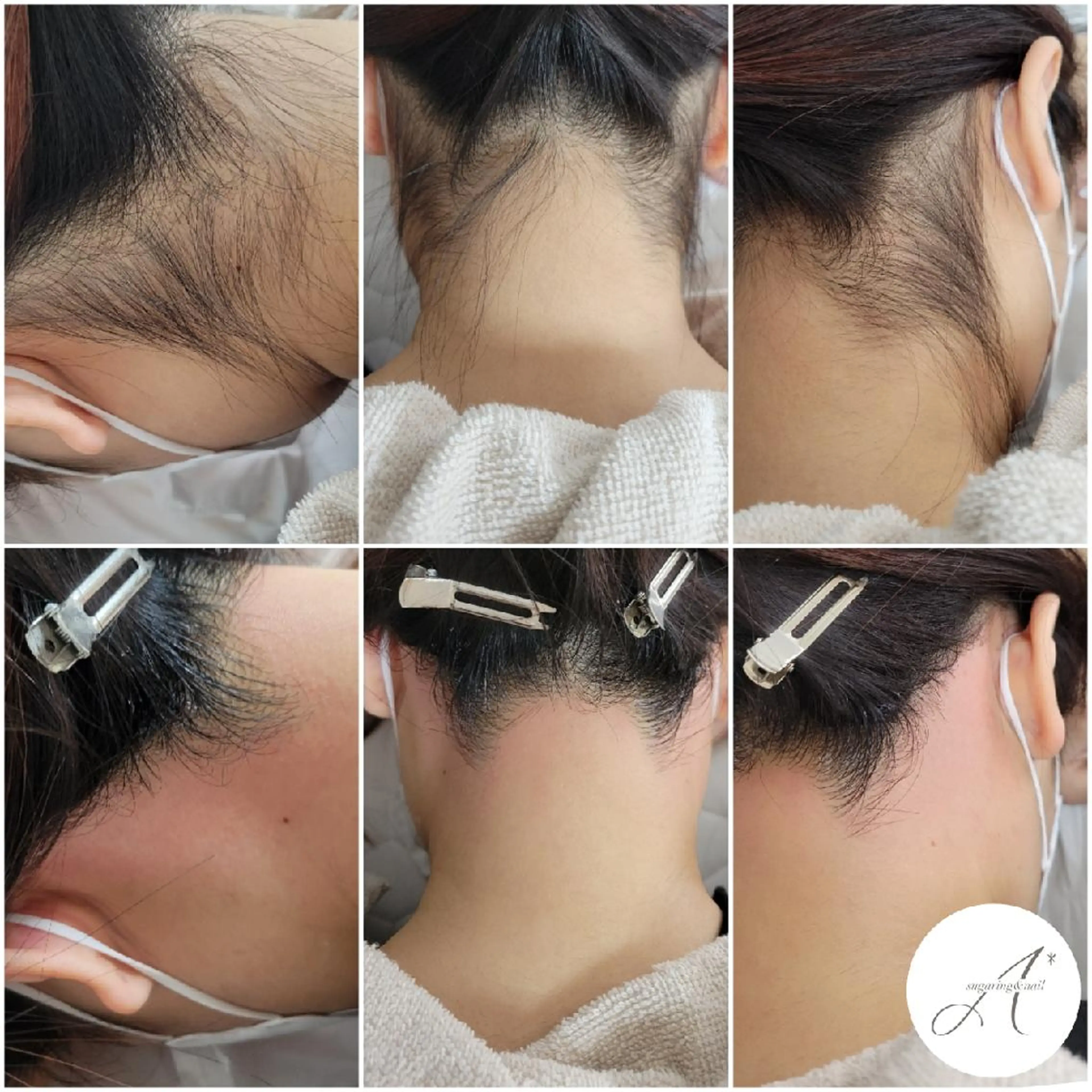 A*《エースター》 シュガーリング🍋のエステ・リラクイメージ