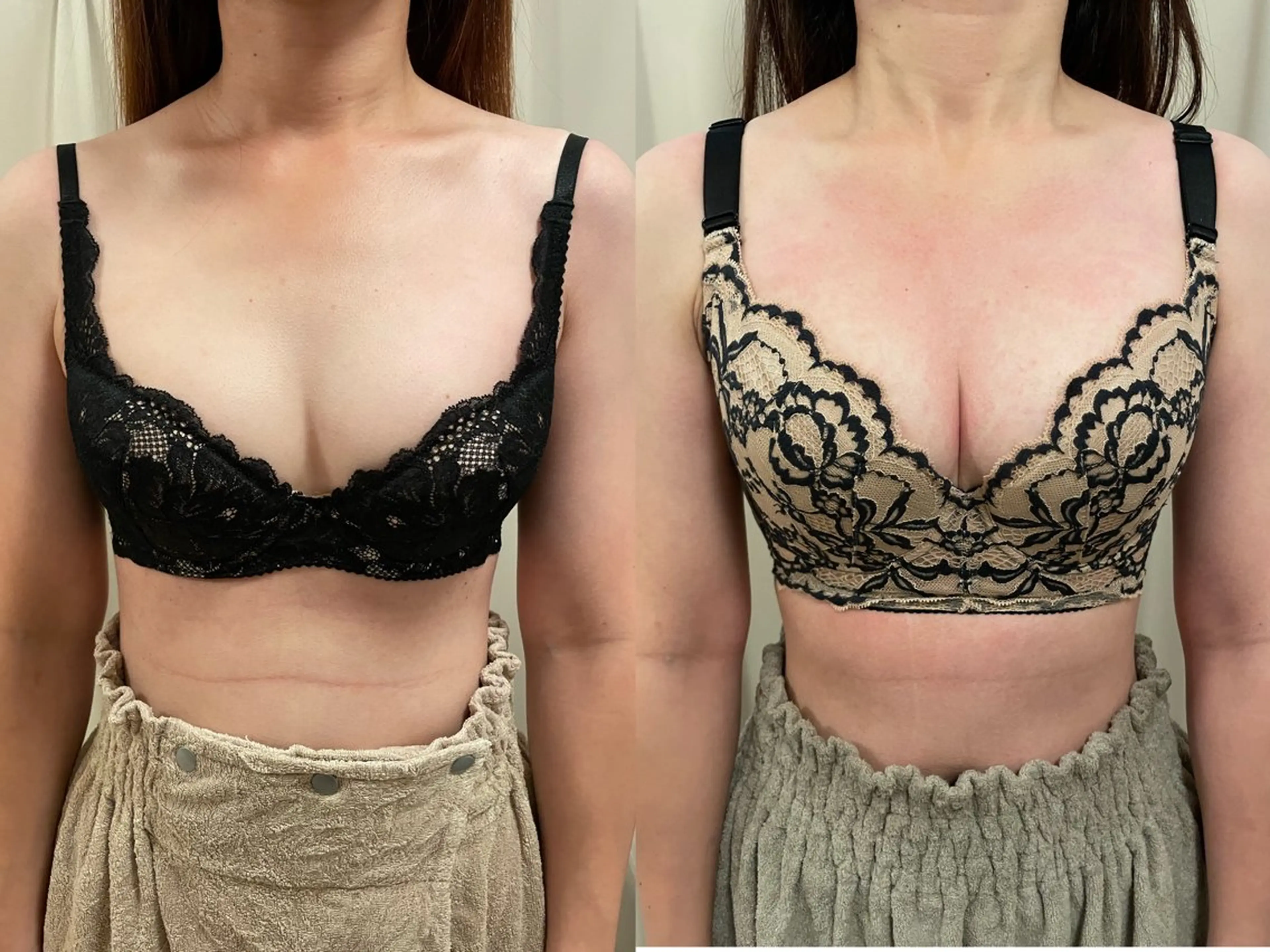 エステ ポテンツァ&針美容 バストアップ専門店のエステ・リラクイメージ