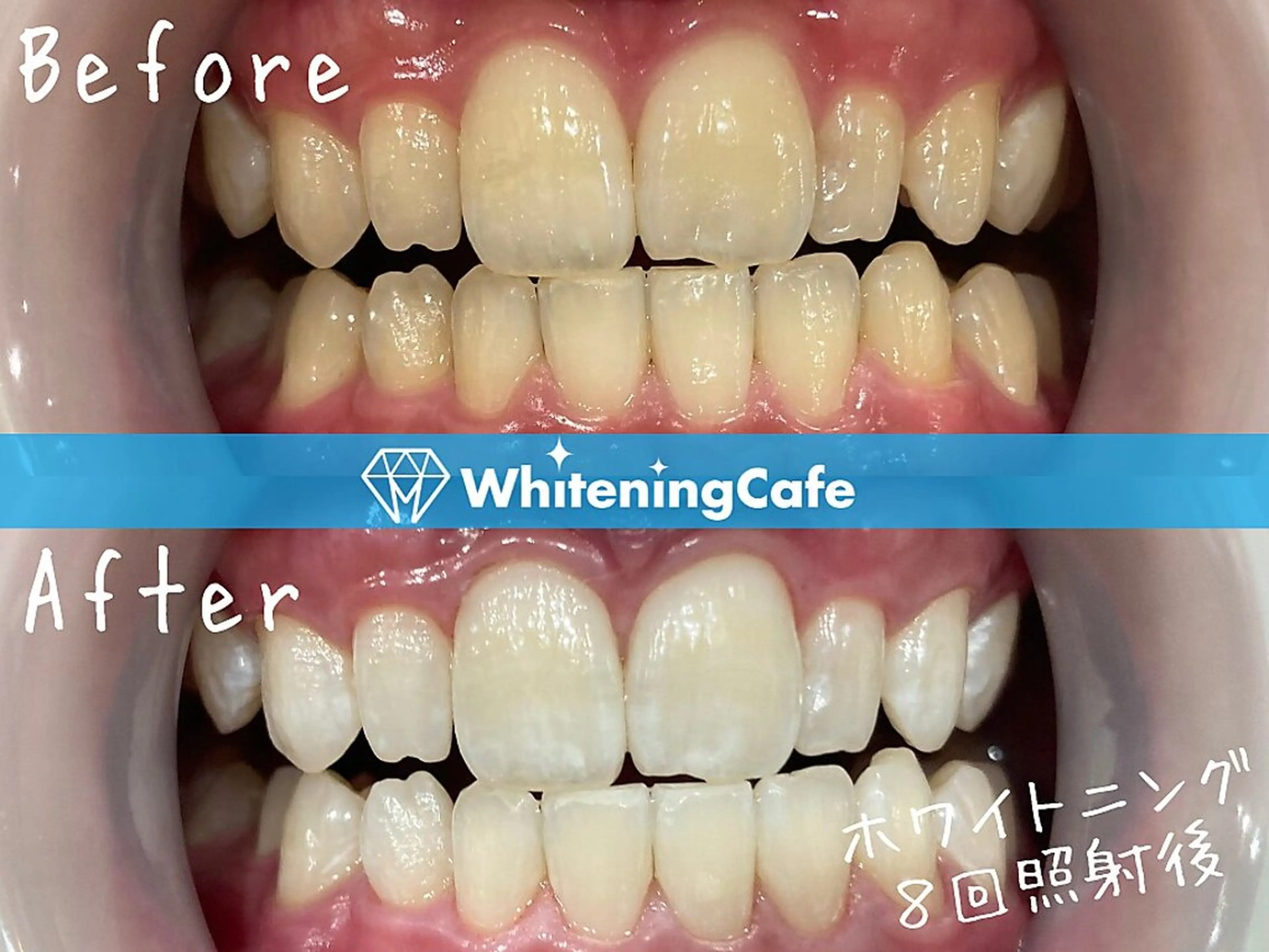 ホワイトニングカフェ原宿店所属・ホワイトニングカフェ 原宿店のエステ・リラクイメージ