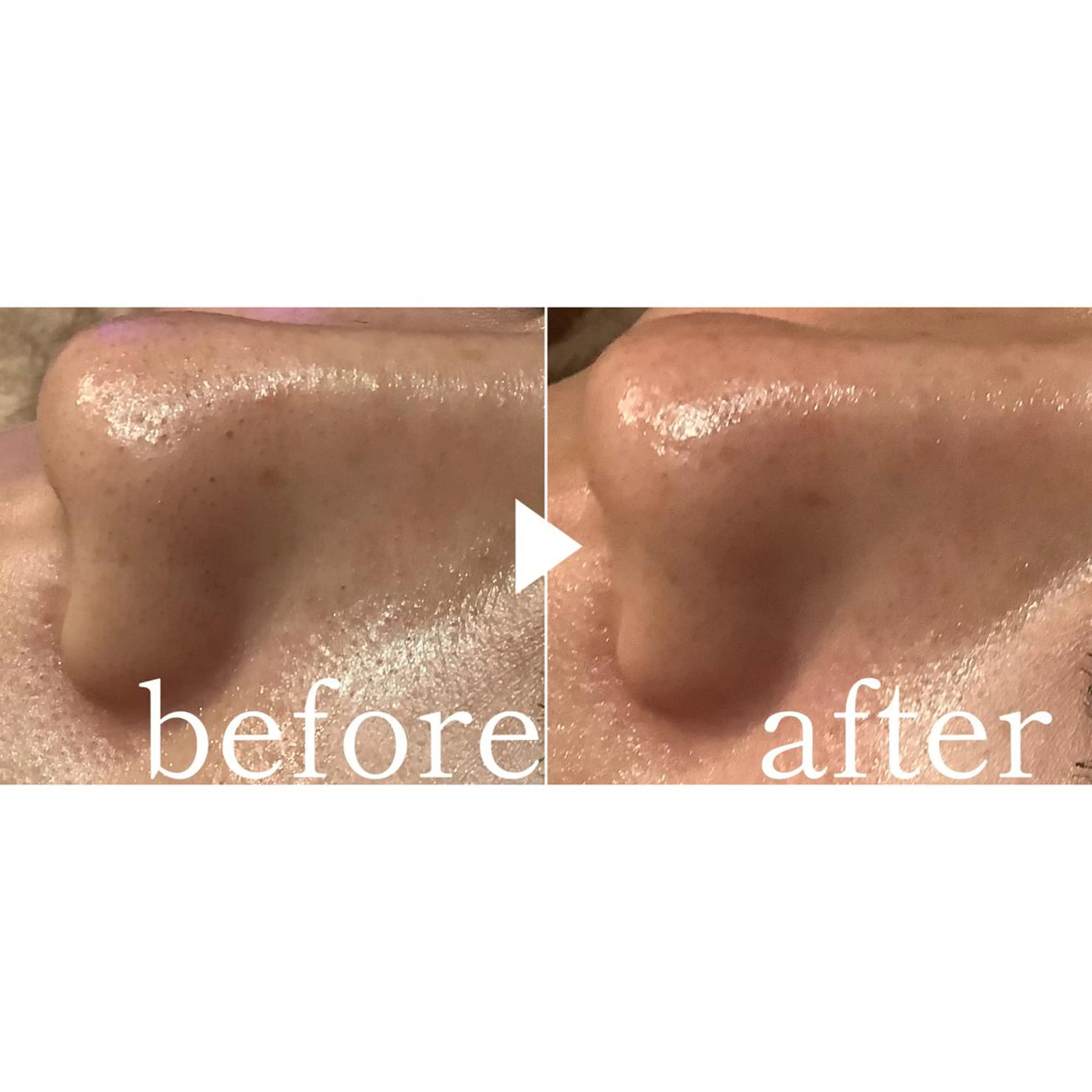 エステ 脱毛&エステサロン JIGGLY武蔵小山のエステ・リラクイメージ