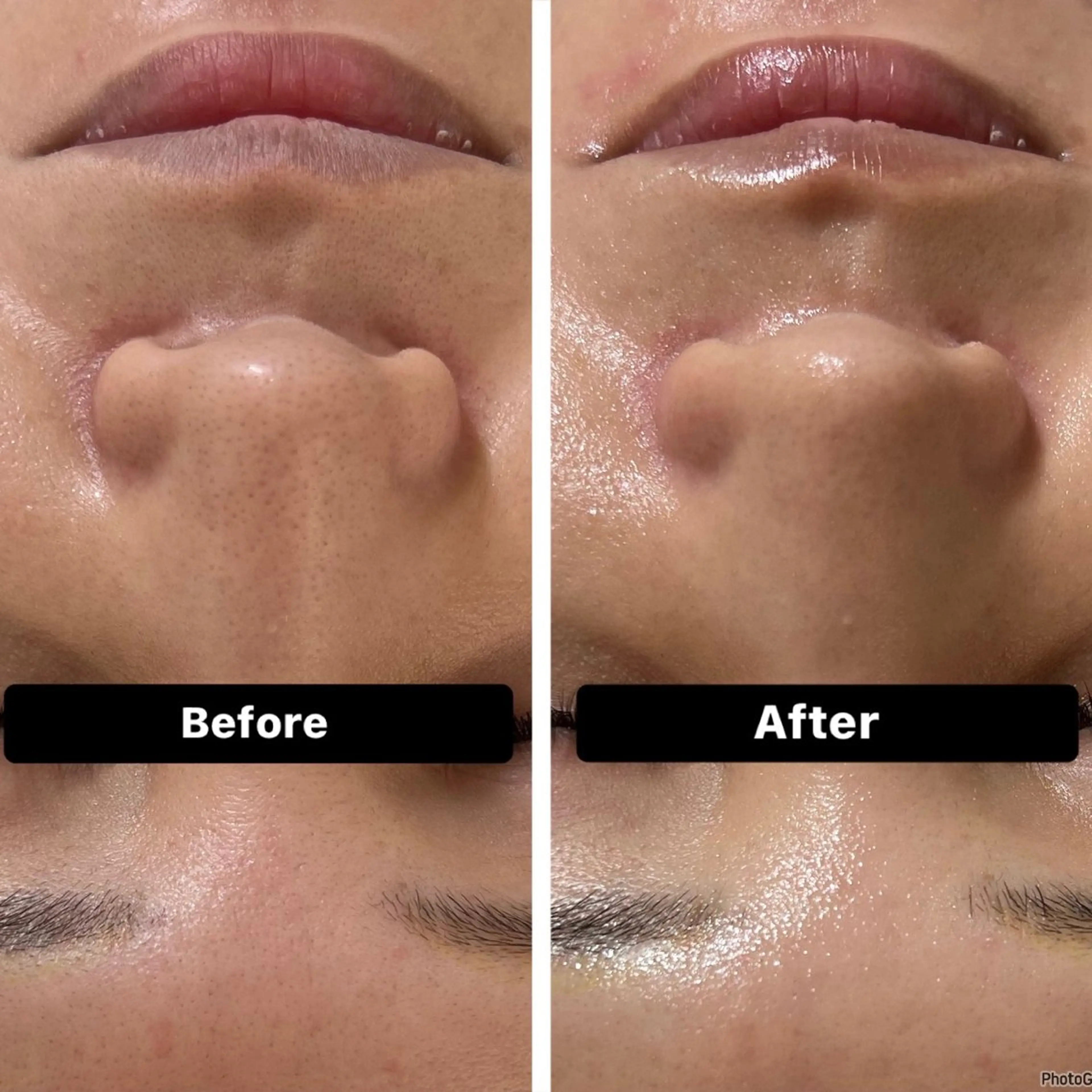 エステ 脱毛&Beauty salon IILA所属・HBL💖 Sakuraの眉毛・アイブロウイメージ