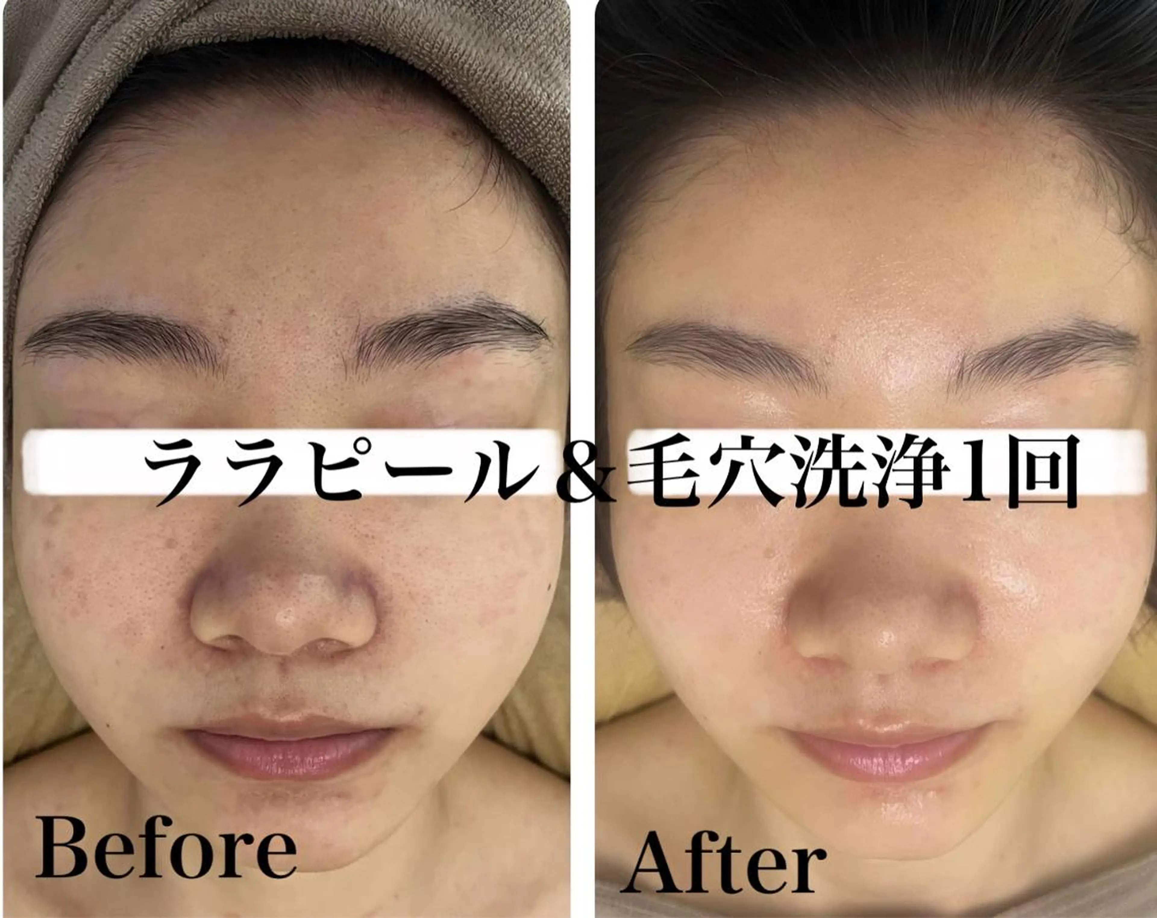 《美肌&小顔サロン》 Masqueradeのエステ・リラクイメージ