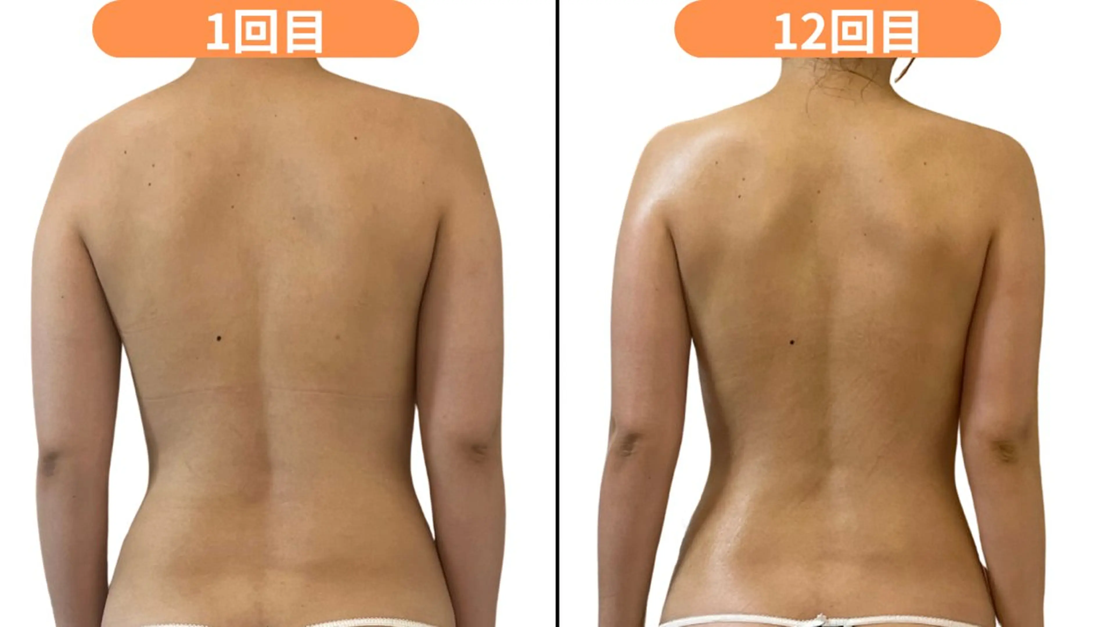 【夏がスタートする前に‼️】3ヶ月短期集中ダイエットお試しコース🌿の写真