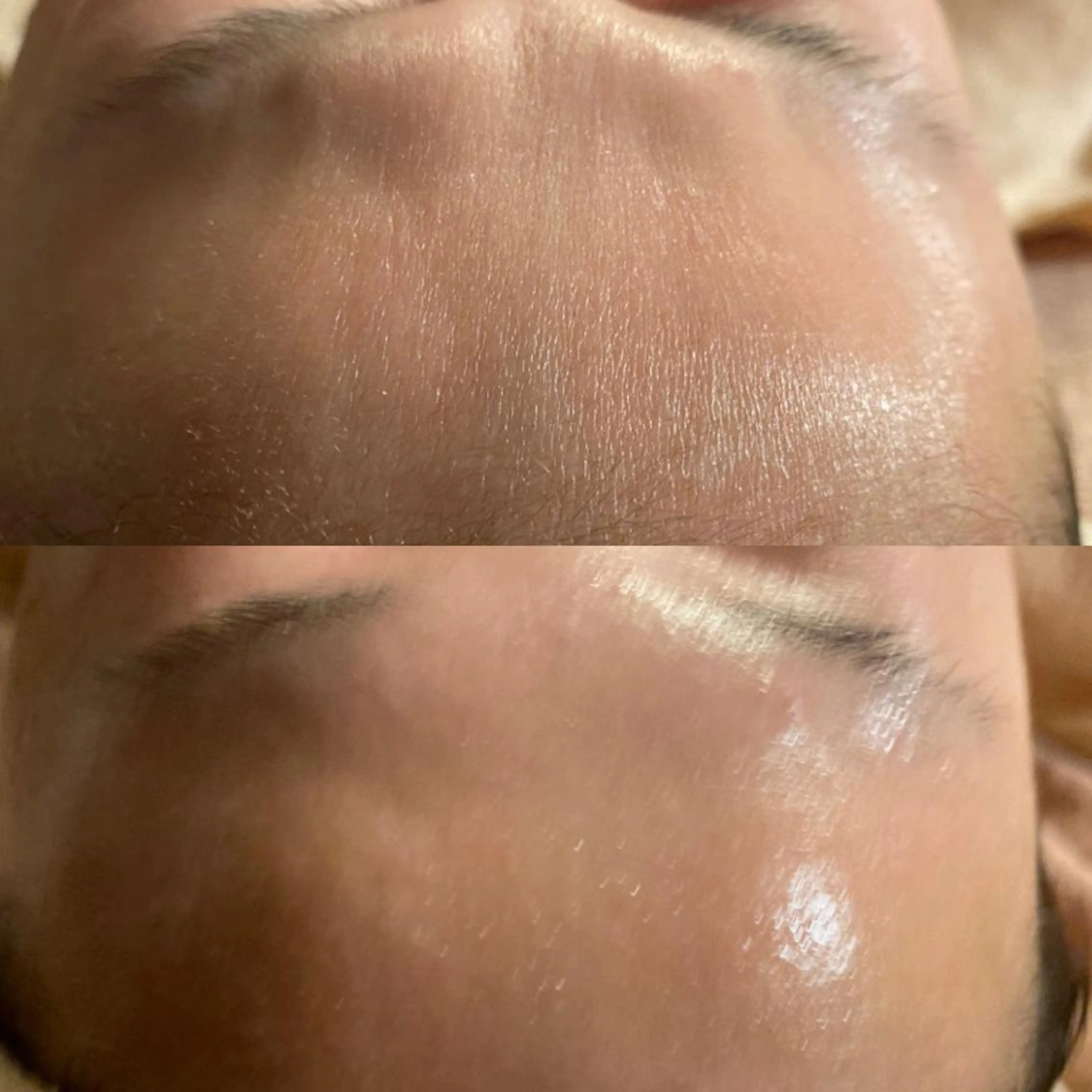 毛穴から始める肌メン テマンダリンオレンジのエステ・リラクイメージ