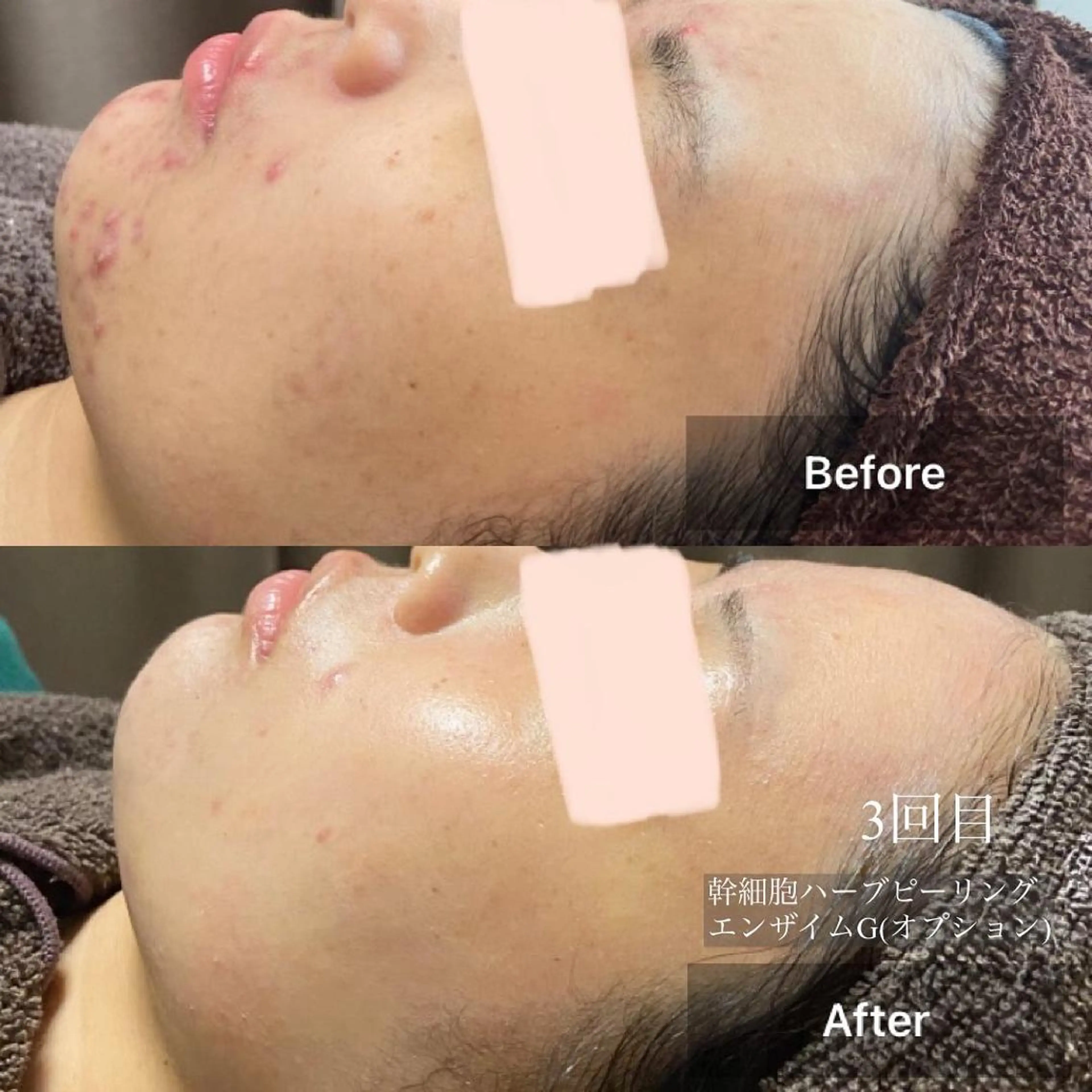 メンズ キッズ エステ 美肌・リラクゼーションサロンLu,Mie所属・美肌と癒しのサロン Lu,Mieのエステ・リラクイメージ