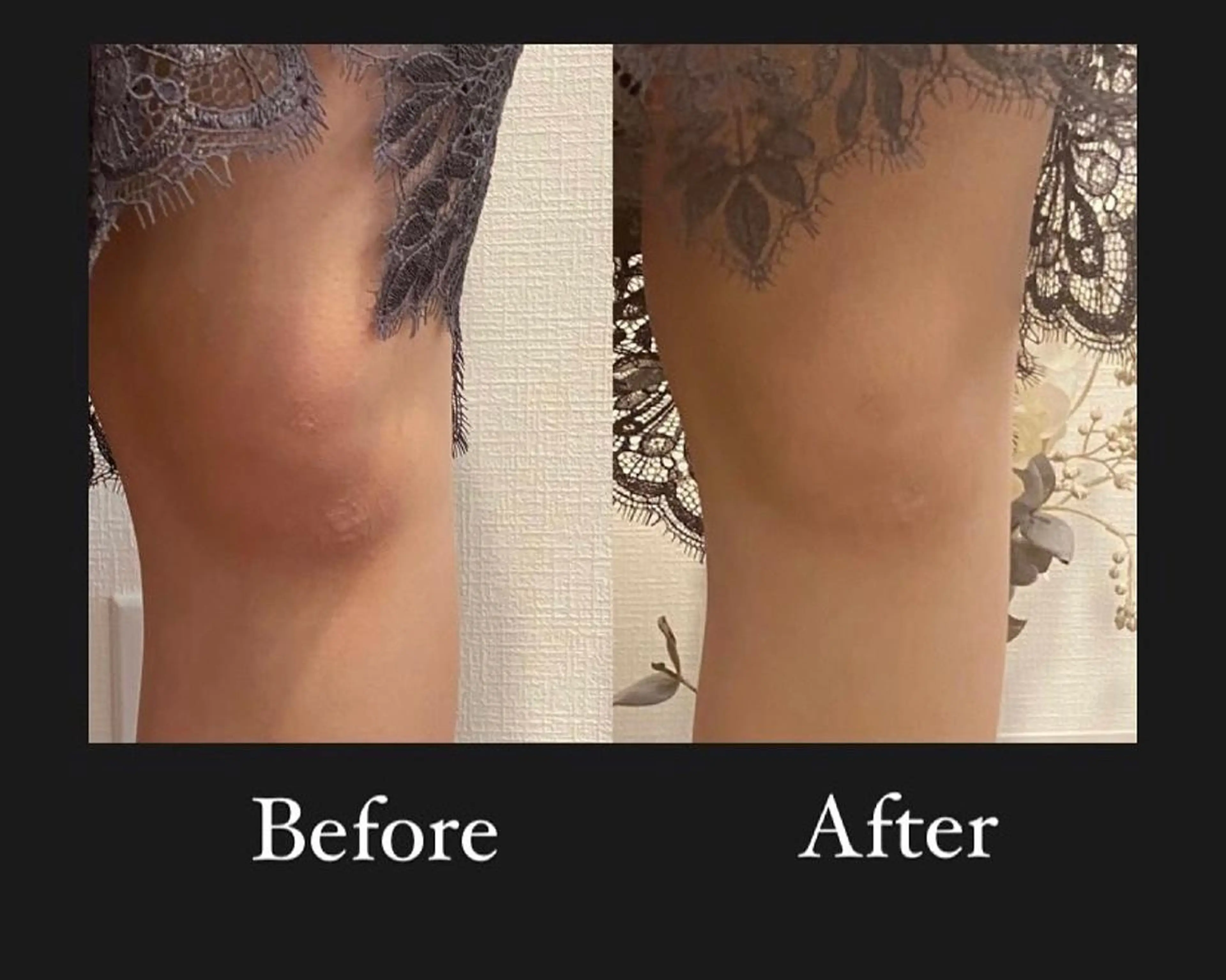 よもぎ蒸し専門店 Artemisiaのエステ・リラクイメージ