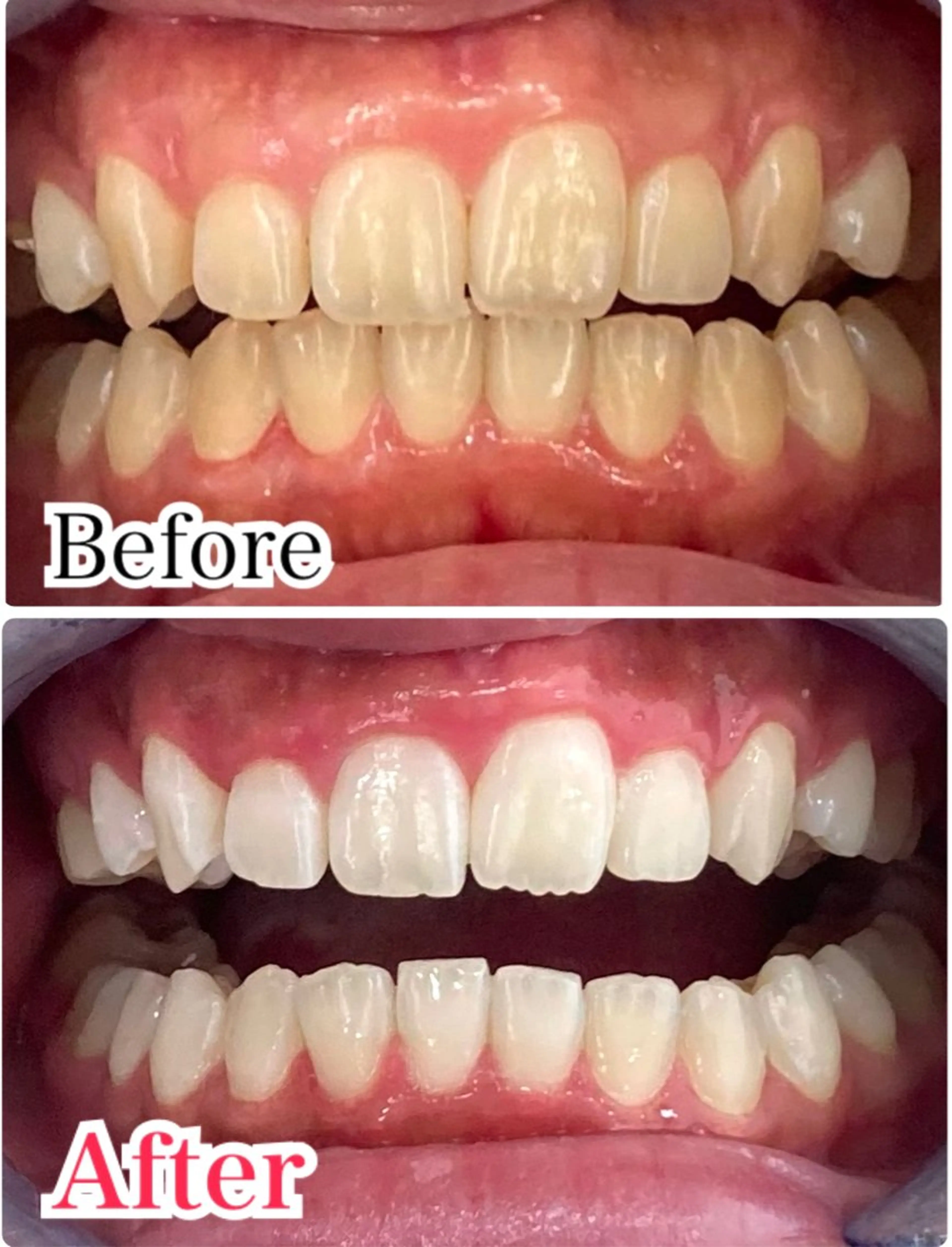 カラー プラチナムビューティー柏所属・【歯科提携】柏ホワイ トニングスタイルのその他イメージ