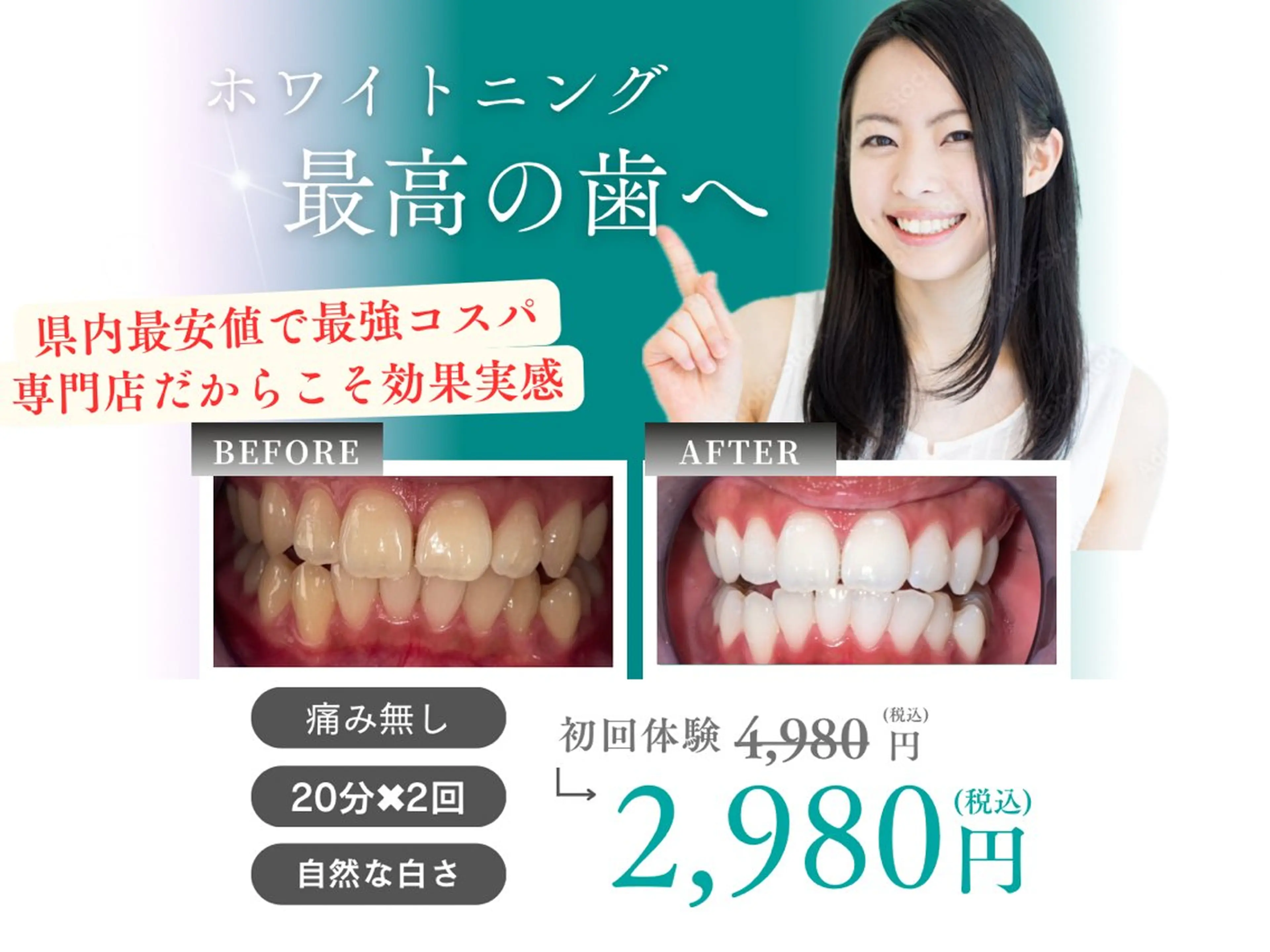 【冬のキャンペーン♪月先着制5名様残り1名様】セルフホワイトニング20分✖️2回セットの写真