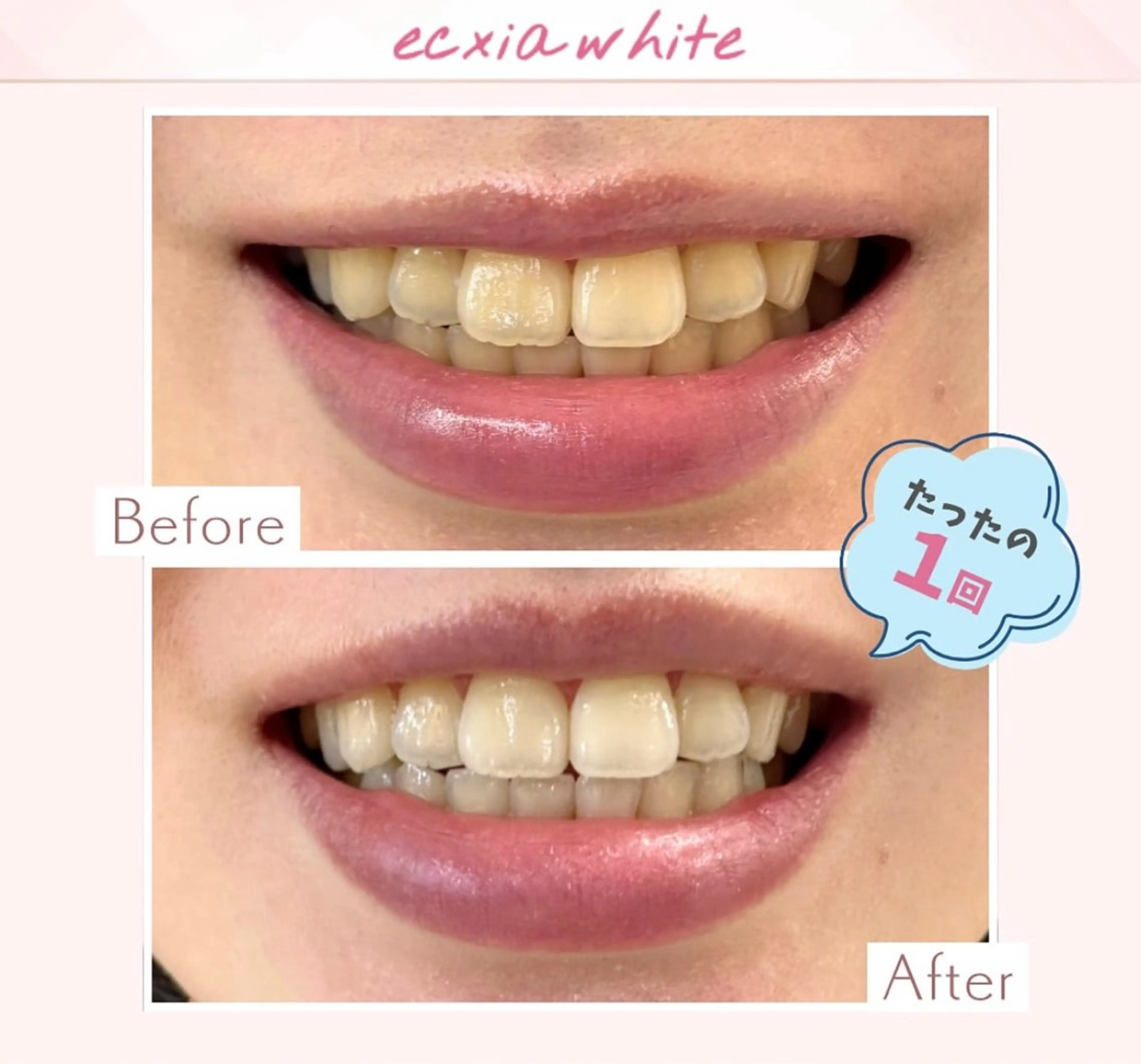 yumi❤︎ ホワイトニングのその他イメージ