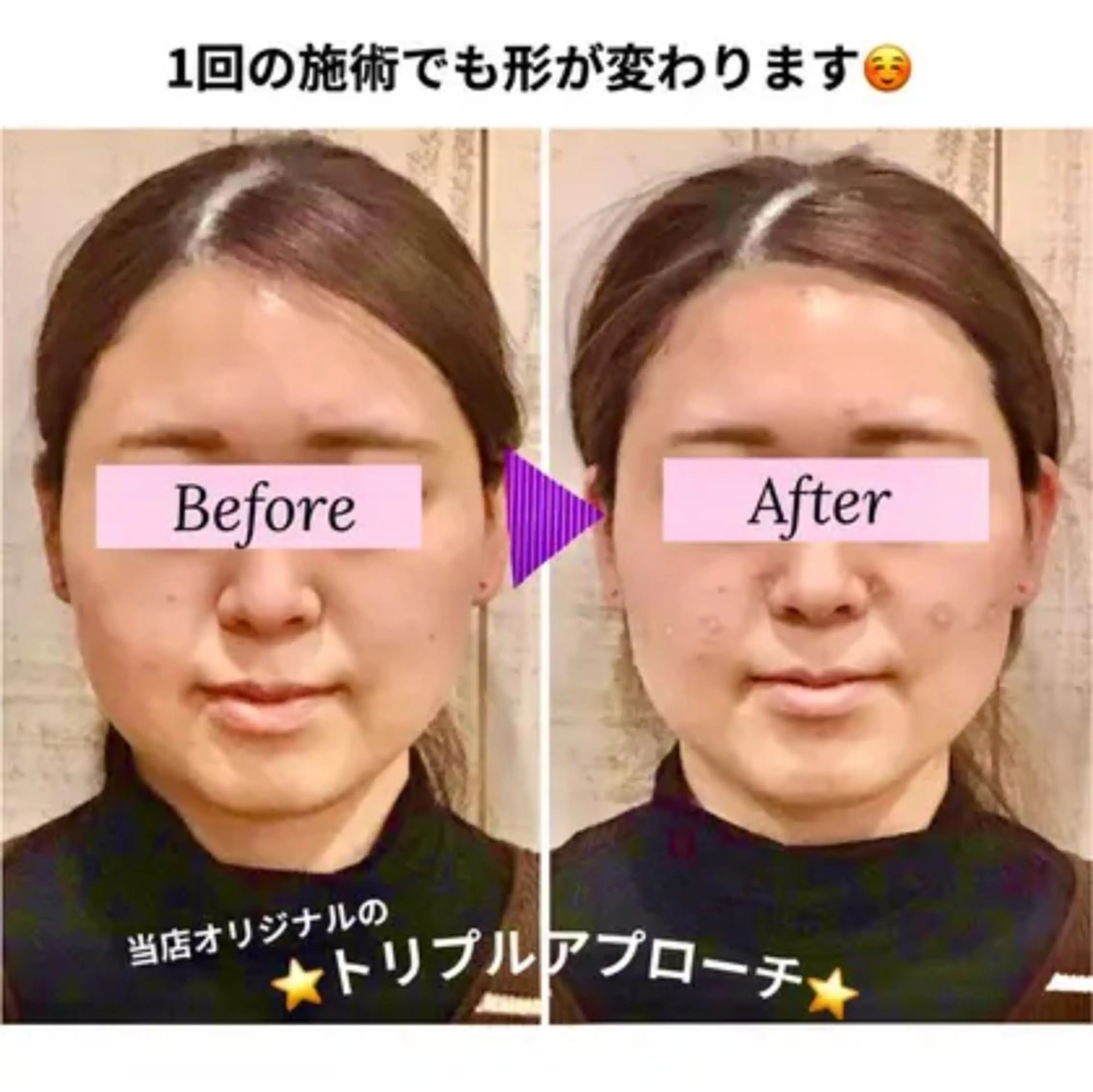 小顔矯正 natsuのエステ・リラクイメージ