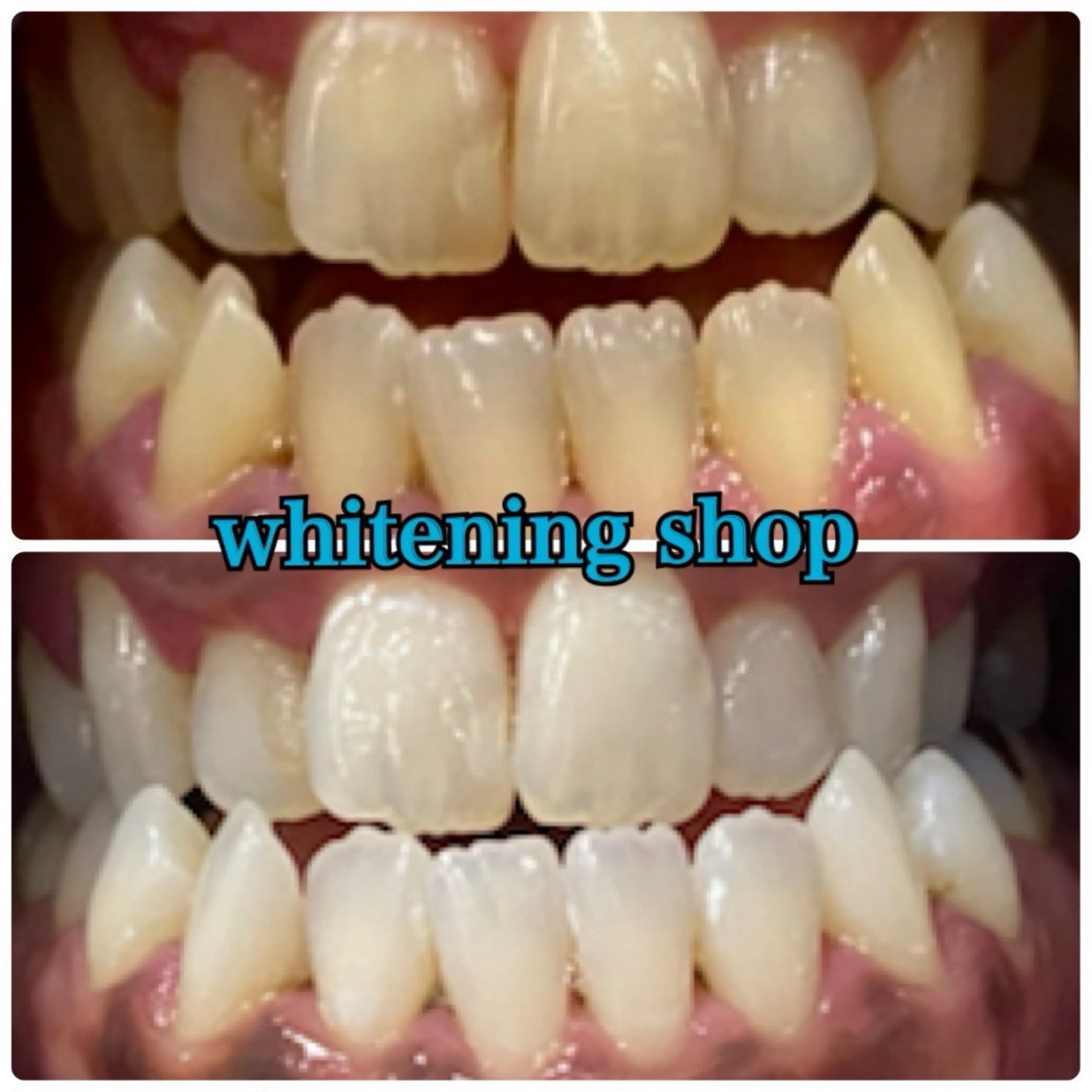 メンズ エステ リラク ホワイトニング ショップ川越店のエステ・リラクイメージ