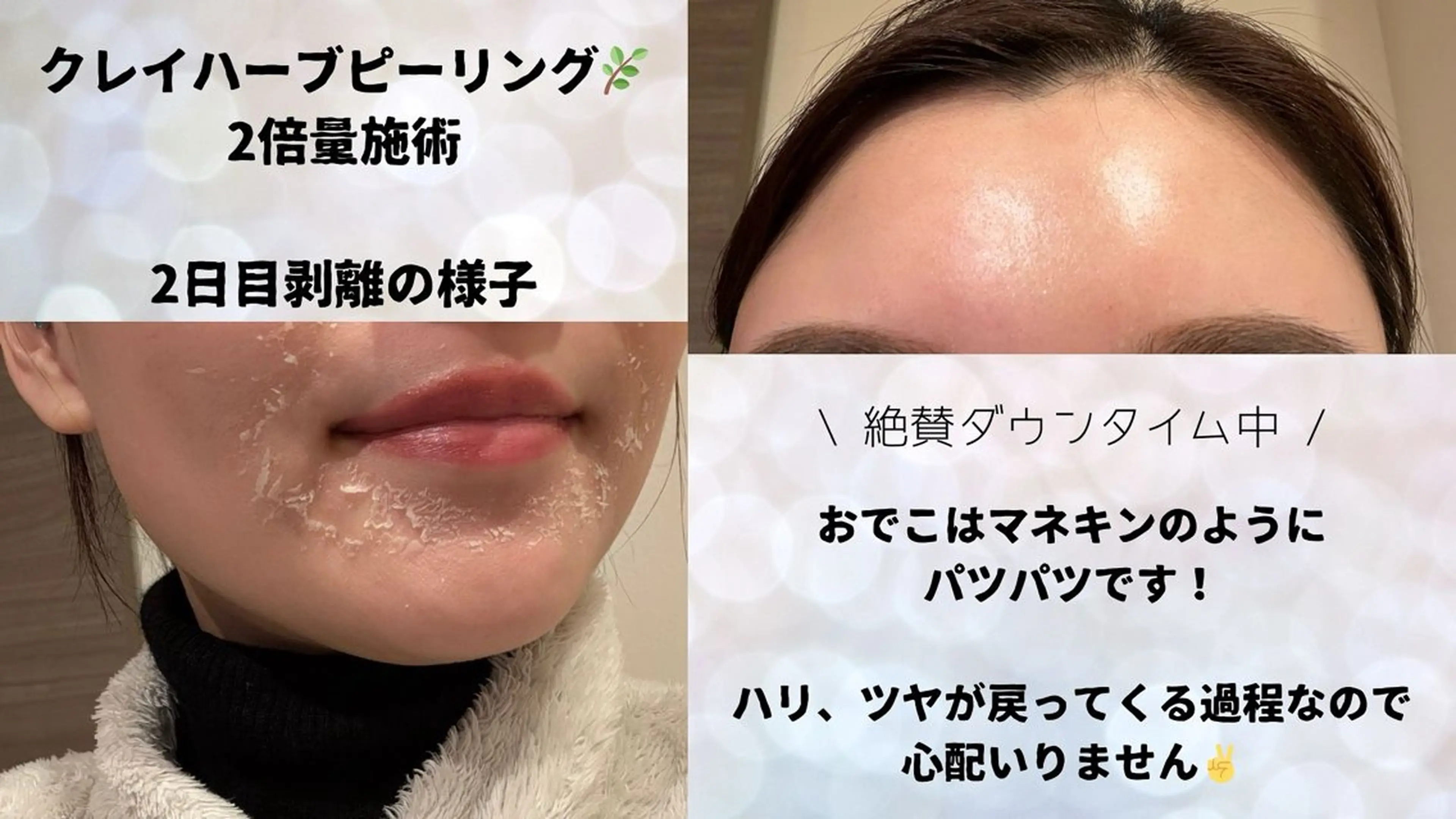 VIKI BEAUTY  クレイハーブピーリング・美肌脱毛専門店所属・VIKI BEAUTYのエステ・リラクイメージ